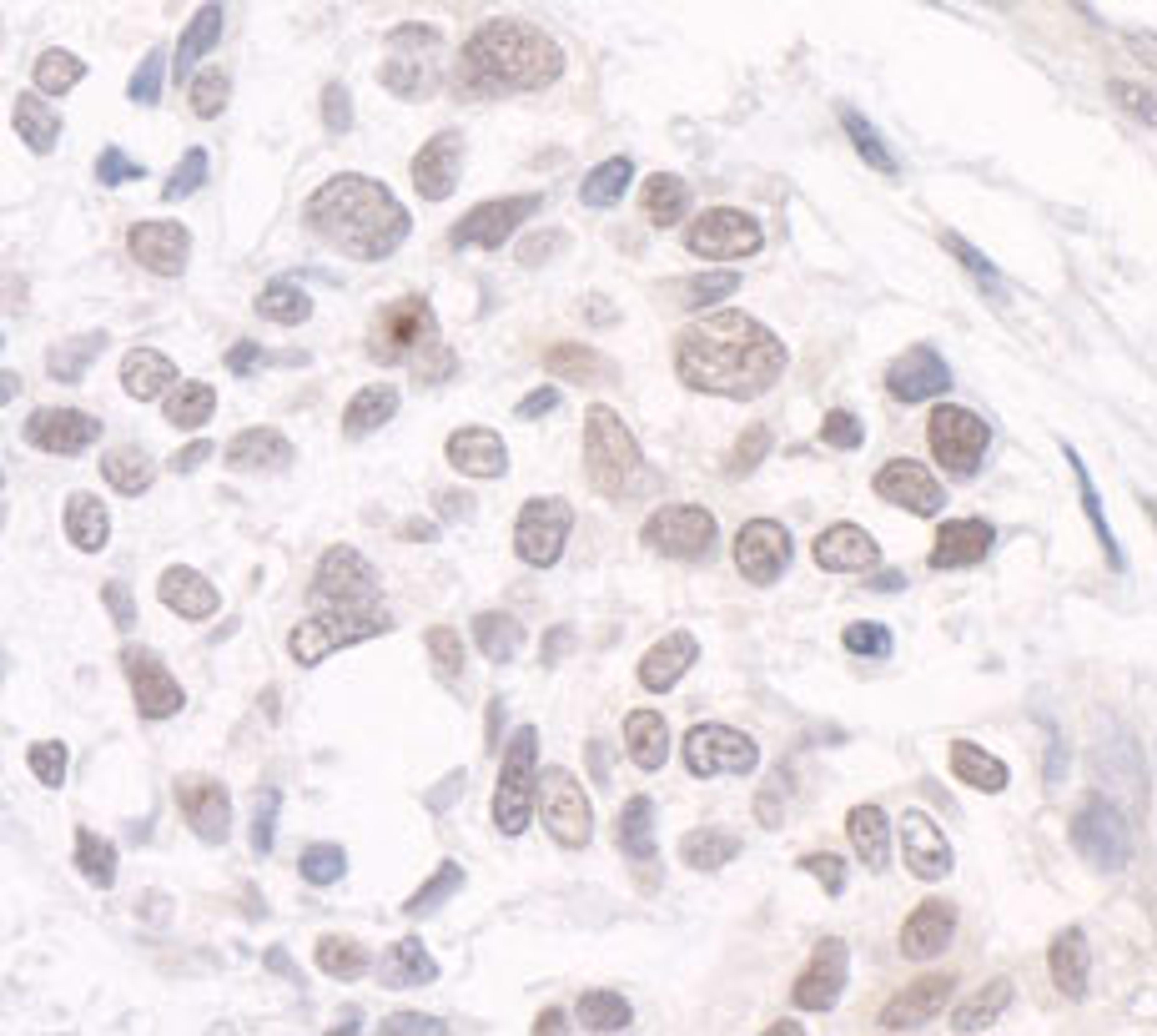 Detection of human GTF3C3/TFIIIC102 by immunohistochemistry.