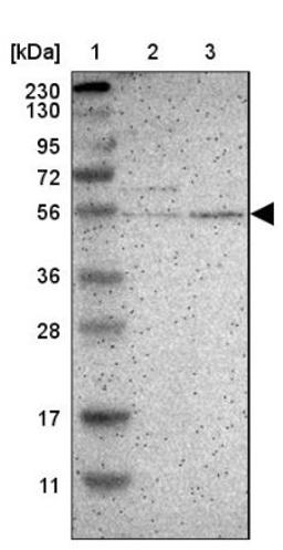 Western Blot: CXorf67 Antibody [NBP2-47499] - Lane 1: Marker [kDa] 230, 130, 95, 72, 56, 36, 28, 17, 11.  Lane 2: Human cell line RT-4.  Lane 3: Human cell line U-251MG.