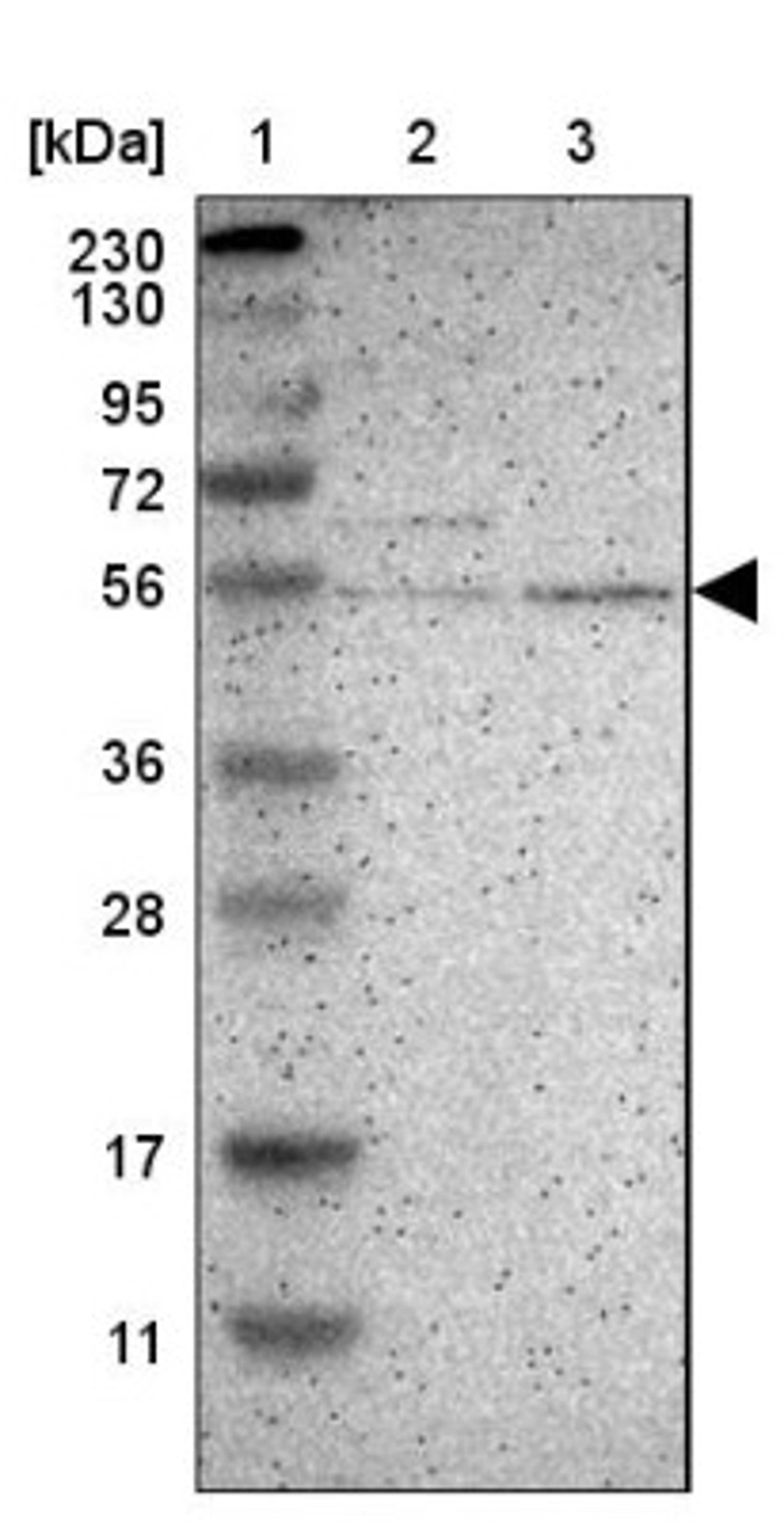 Western Blot: CXorf67 Antibody [NBP2-47499] - Lane 1: Marker [kDa] 230, 130, 95, 72, 56, 36, 28, 17, 11.  Lane 2: Human cell line RT-4.  Lane 3: Human cell line U-251MG.