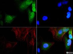 Immunocytochemistry/Immunofluorescence: GABARAP Antibody [NBP1-71771] - GABARAP antibody was tested in HeLa cells with FITC (green). Nuclei and actin were counterstained with Dapi (blue) and Phalloidin (red).