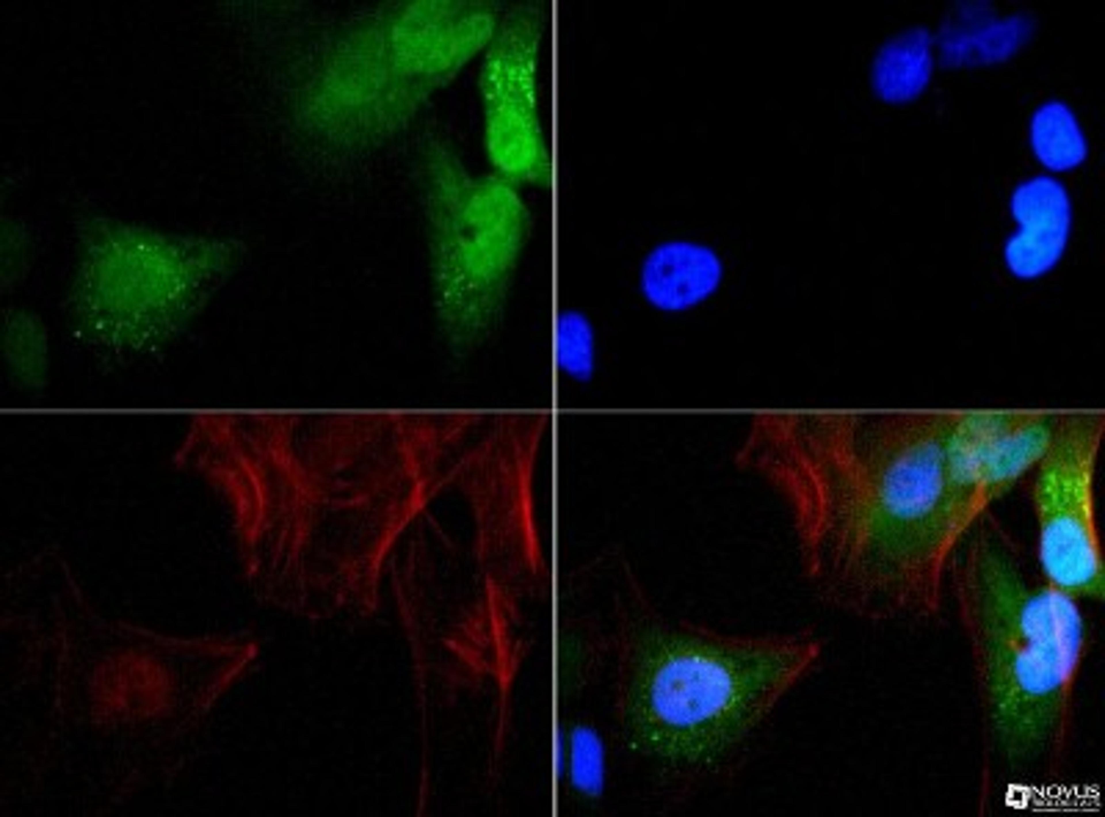 Immunocytochemistry/Immunofluorescence: GABARAP Antibody [NBP1-71771] - GABARAP antibody was tested in HeLa cells with FITC (green). Nuclei and actin were counterstained with Dapi (blue) and Phalloidin (red).