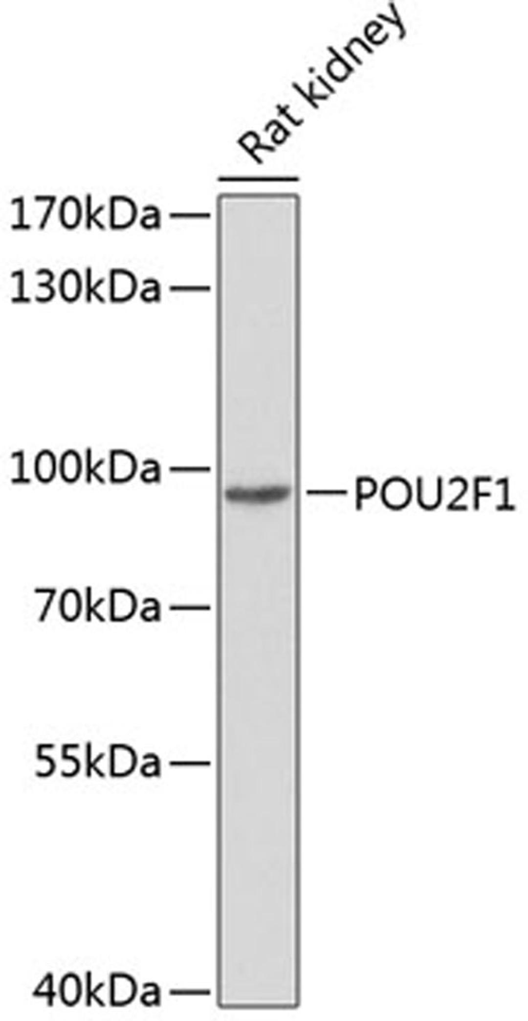 Western blot - POU2F1 antibody (A1682)