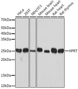 Western blot - HPRT Rabbit mAb (A8783)