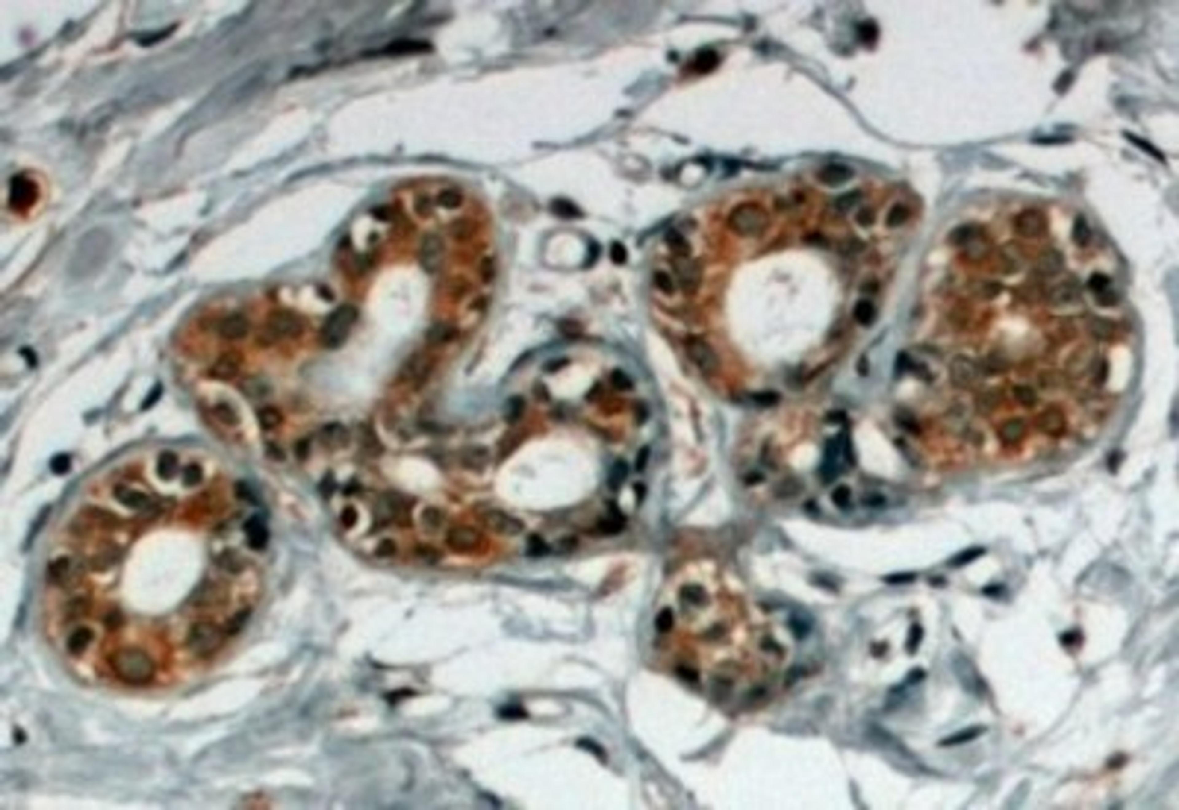 Immunohistochemistry-Paraffin: SNX5 Antibody [NB100-1362] - (4ug/ml) staining of paraffin embedded Human Breast. Steamed antigen retrieval with citrate buffer pH 6, HRP-staining.