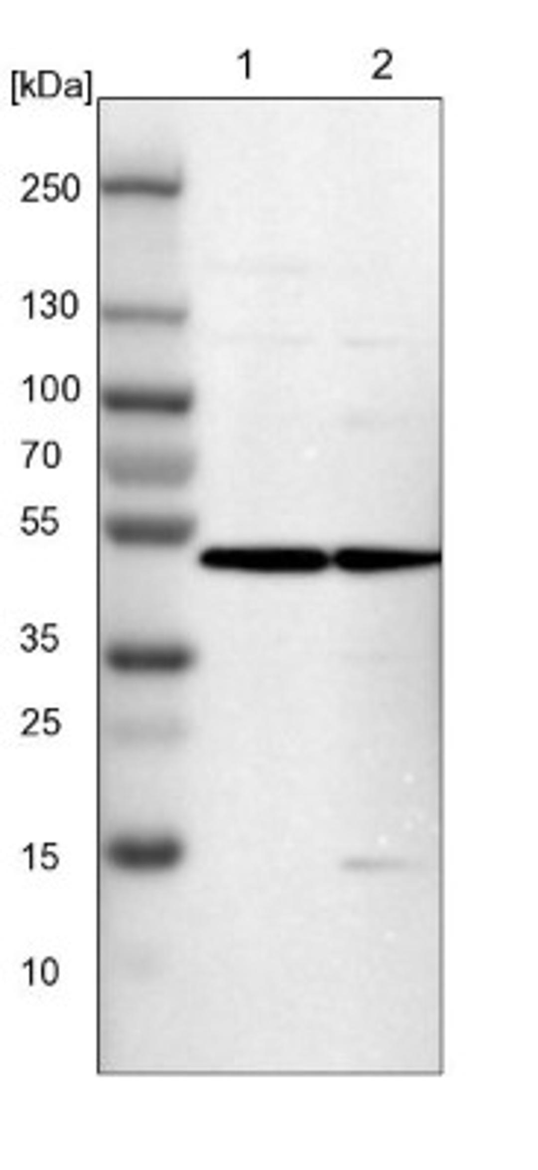 Western Blot: ZNF341 Antibody [NBP1-84218] - Lane 1: NIH-3T3 cell lysate (Mouse embryonic fibroblast cells)<br/>Lane 2: NBT-II cell lysate (Rat Wistar bladder tumour cells)