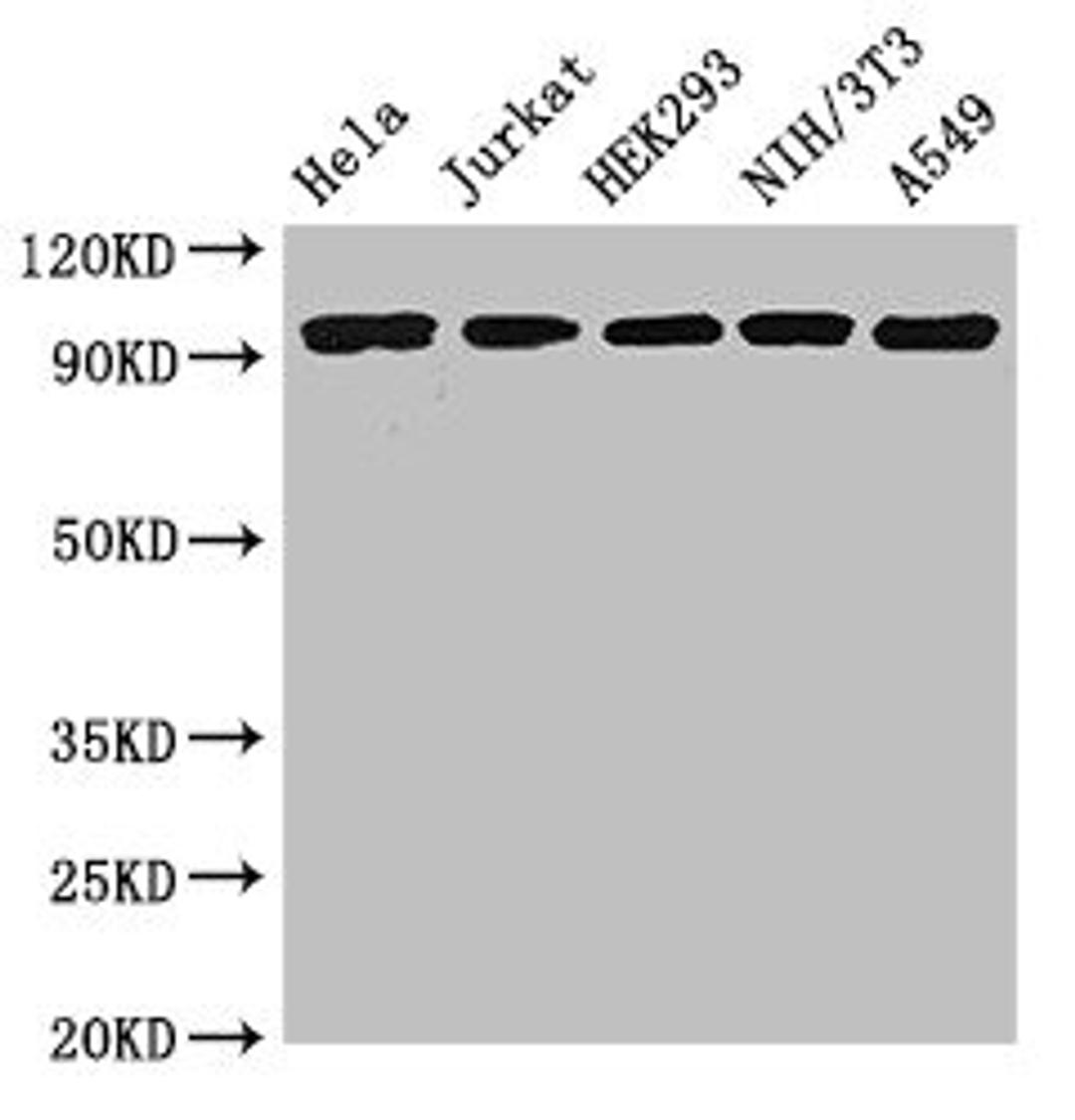 Western Blot. Positive WB detected in: Hela whole cell lysate, Jurkat whole cell lysate, HEK293 whole cell lysate, NIH/3T3 whole cell lysate, A549 whole cell lysate. All lanes: DDR2 antibody at 3.5ug/ml. Secondary. Goat polyclonal to rabbit IgG at 1/50000 dilution. Predicted band size: 97 kDa. Observed band size: 97 kDa. 