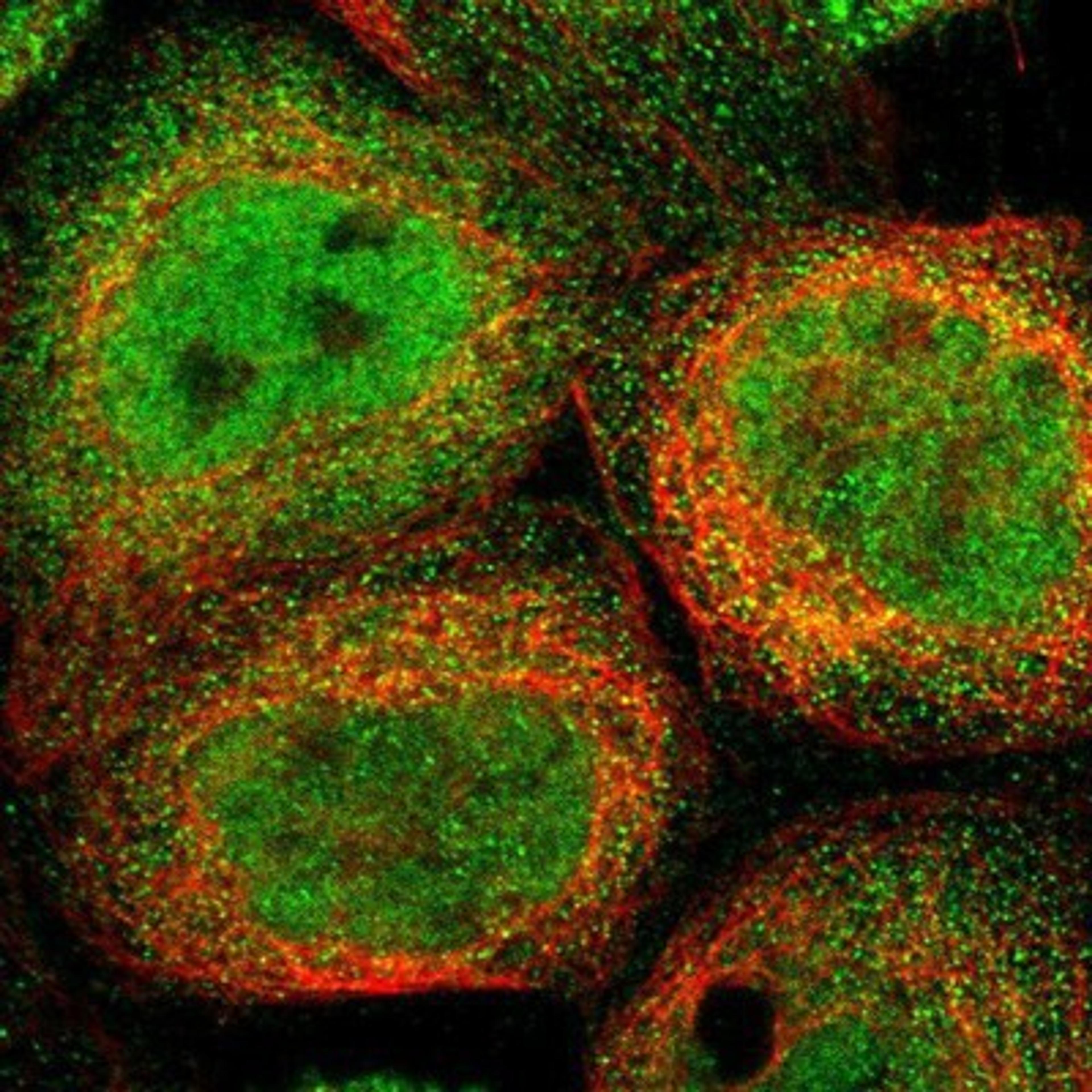 Immunocytochemistry/Immunofluorescence: SELM Antibody [NBP1-90883] Staining of human cell line A-431 shows positivity in nucleus but not nucleoli & cytoplasm.