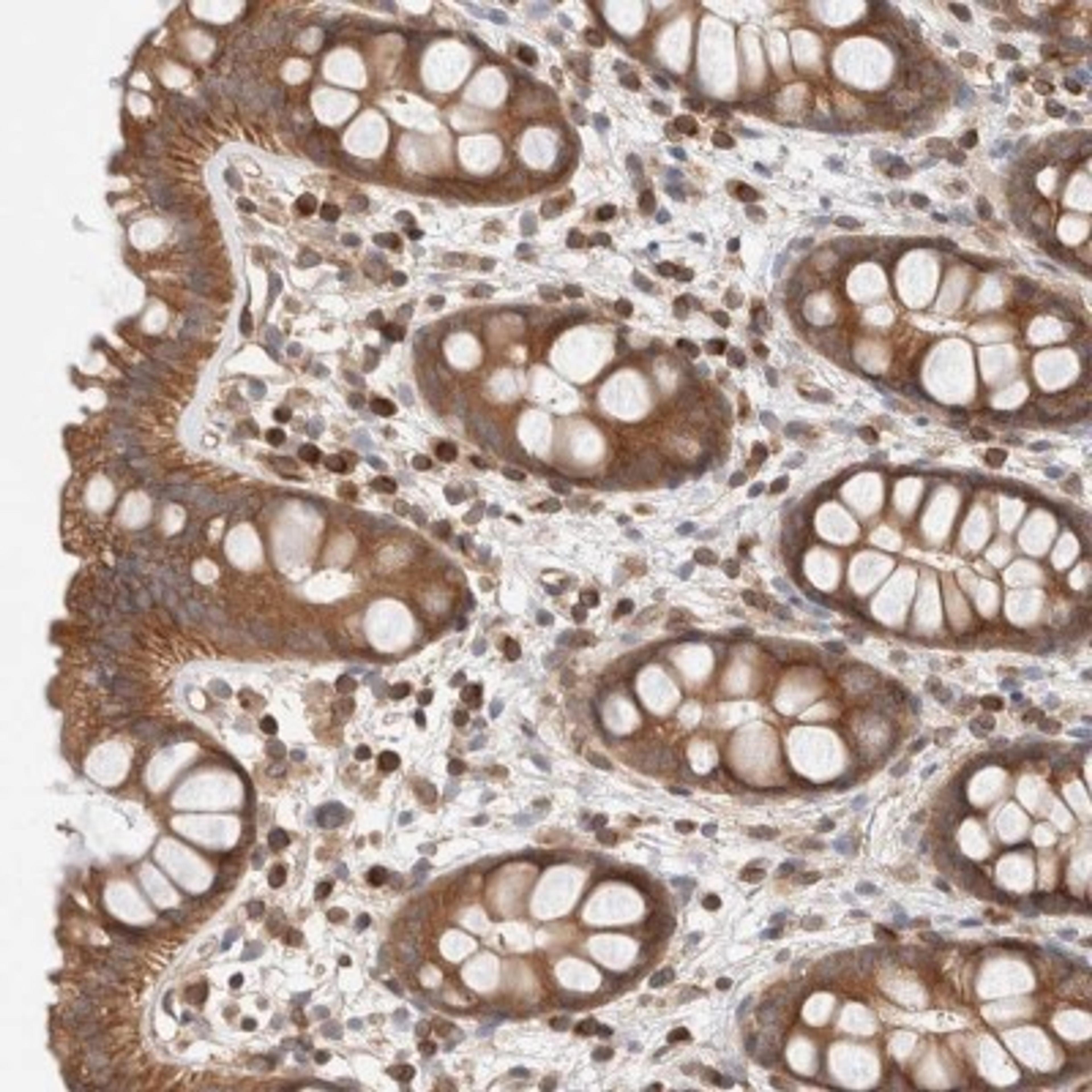 Immunohistochemistry-Paraffin: SIKE1 Antibody [NBP1-82151] - Staining of human rectum shows moderate cytoplasmic positivity in glandular cells.