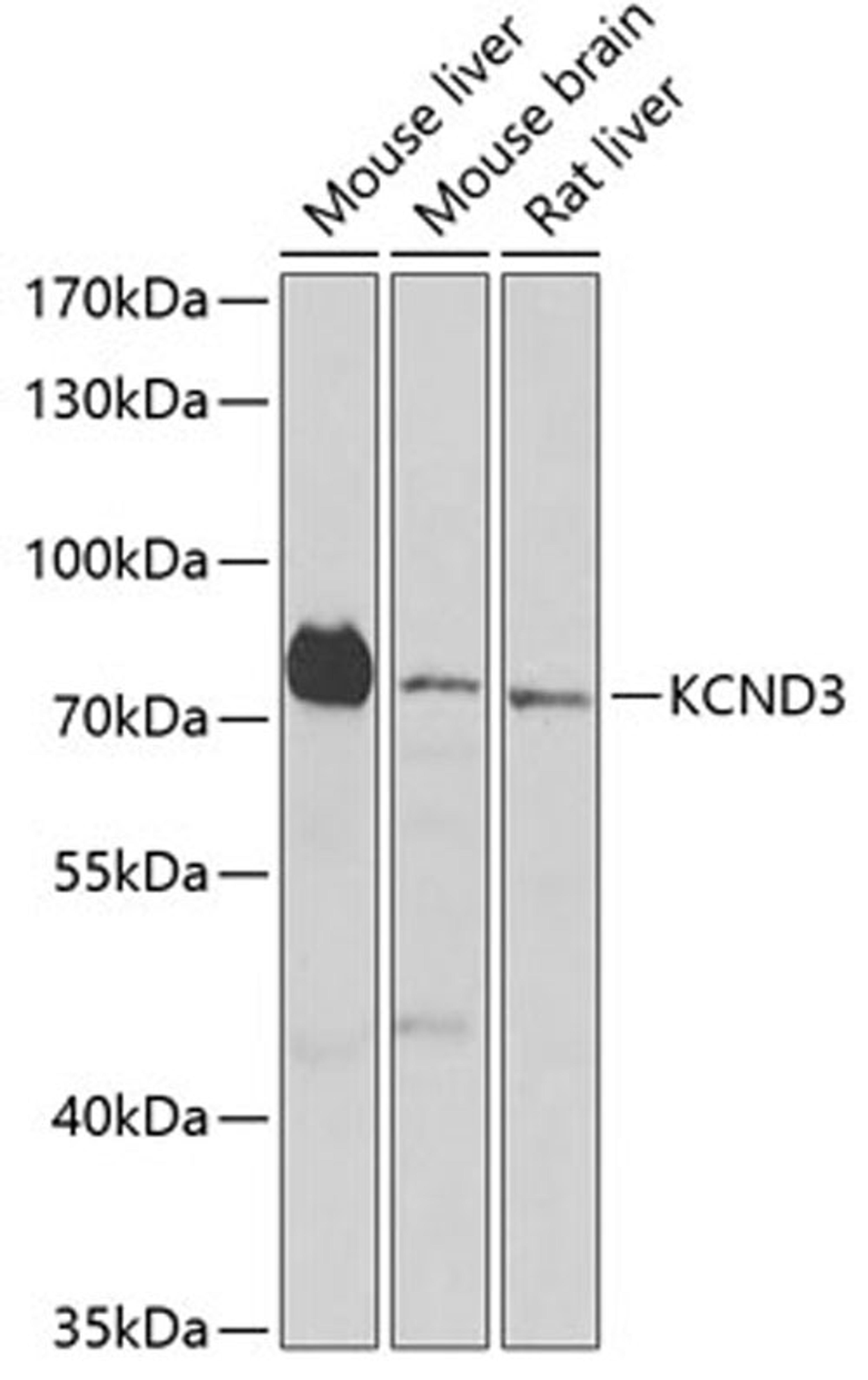 Western blot - KCND3 antibody (A6927)