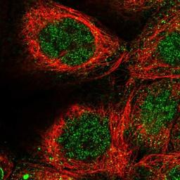 Immunocytochemistry/Immunofluorescence: ZFYVE27 Antibody [NBP1-83512] - Staining of human cell line A-431 shows positivity in nucleus but not nucleoli & cytoplasm.