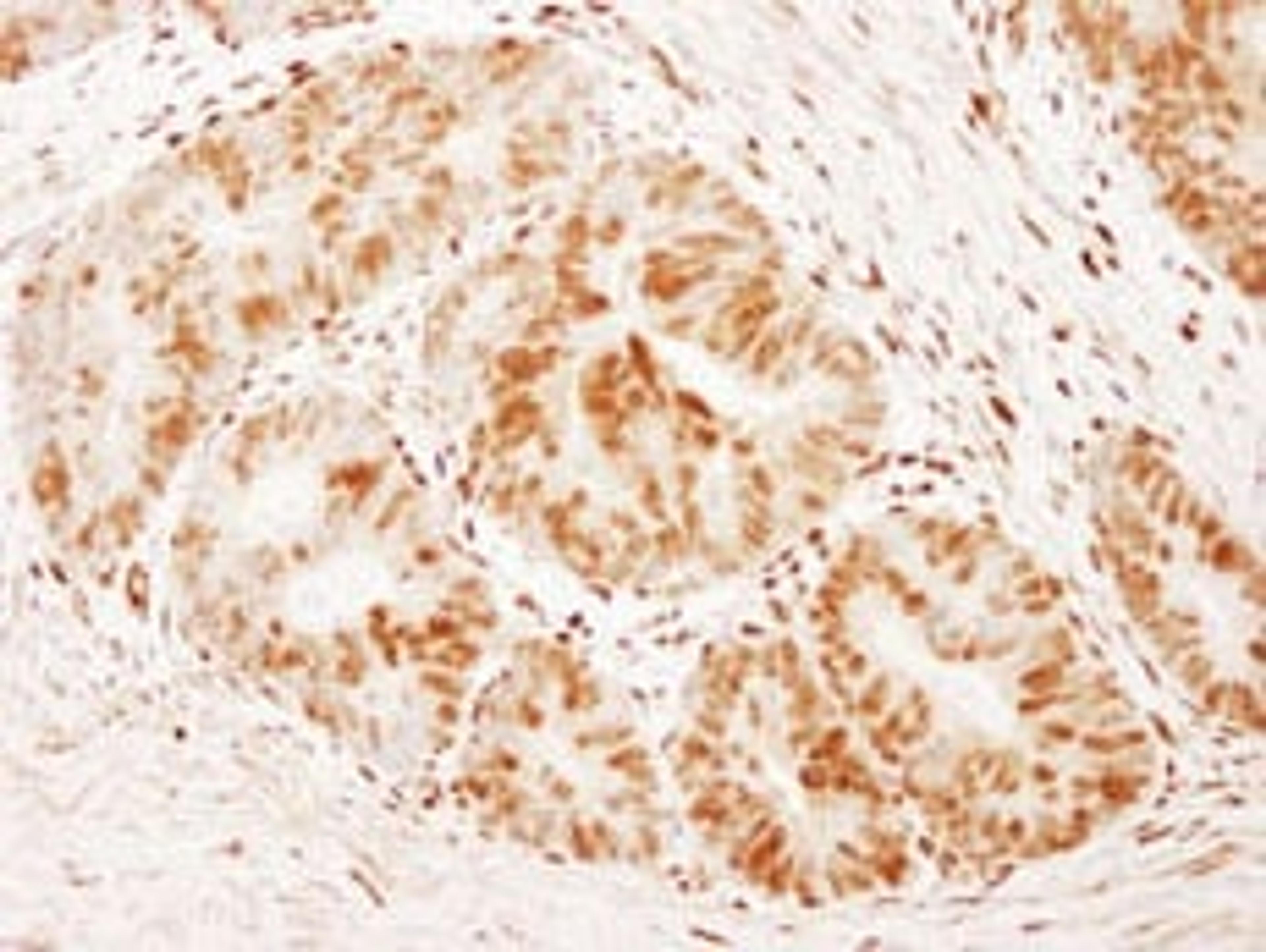 Detection of human FOXK1 by immunohistochemistry.