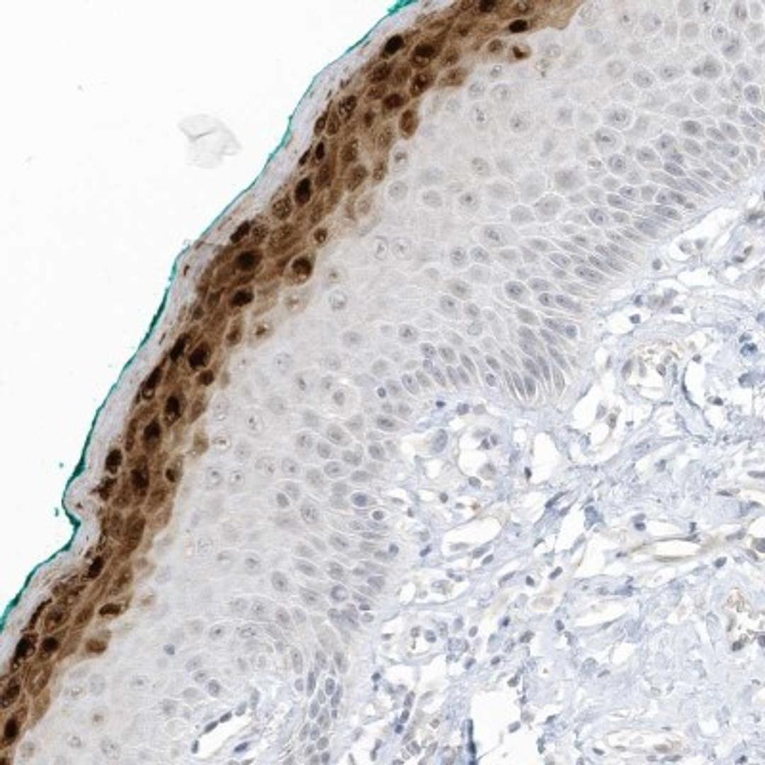 Immunohistochemistry-Paraffin: ASPRV1 Antibody [NBP2-33981] - Immunohistochemical staining of human oral mucosa shows strong cytoplasmic and nuclear positivity in superficial squamous epithelial cells.