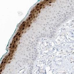 Immunohistochemistry-Paraffin: ASPRV1 Antibody [NBP2-33981] - Immunohistochemical staining of human oral mucosa shows strong cytoplasmic and nuclear positivity in superficial squamous epithelial cells.