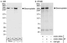 Detection of human Desmoplakin by western blot and immunoprecipitation.