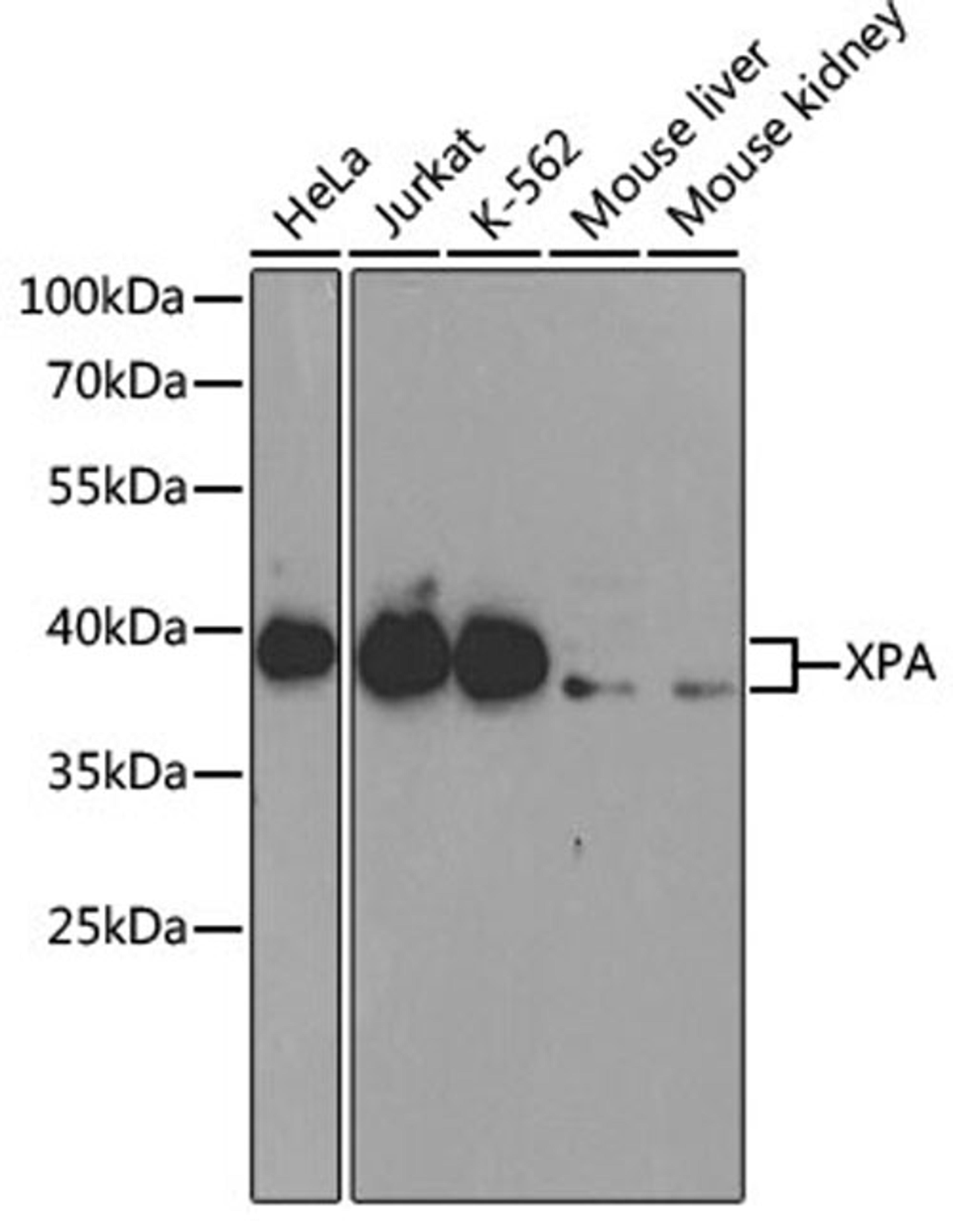 Western blot - XPA antibody (A1626)