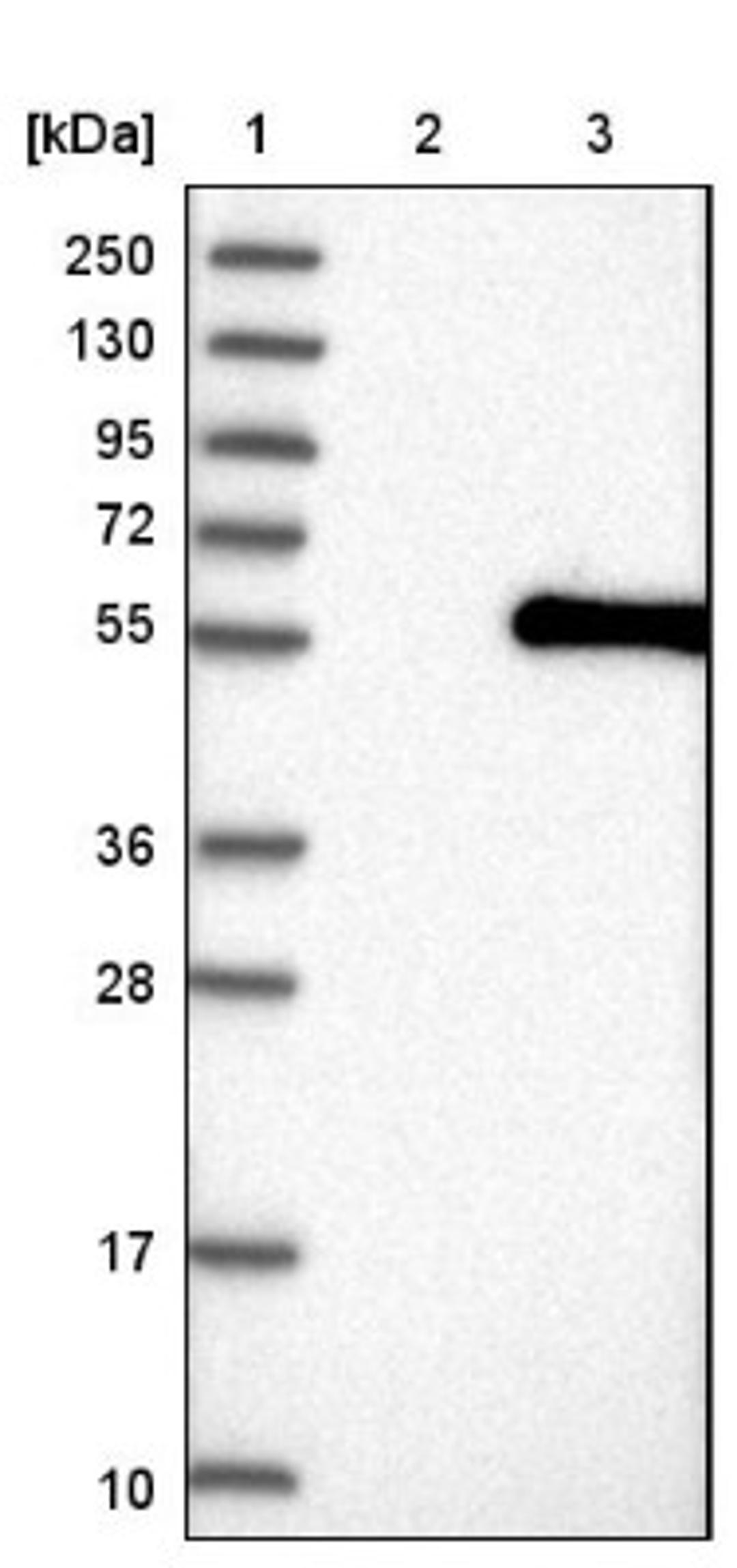 Western Blot: ABHD8 Antibody [NBP1-83728] - Lane 1: Marker [kDa] 250, 130, 95, 72, 55, 36, 28, 17, 10<br/>Lane 2: Negative control (vector only transfected HEK293T lysate)<br/>Lane 3: Over-expression lysate (Co-expressed with a C-terminal myc-DDK tag (~3.1 kDa) in mammalian HEK293T cells, LY411270)