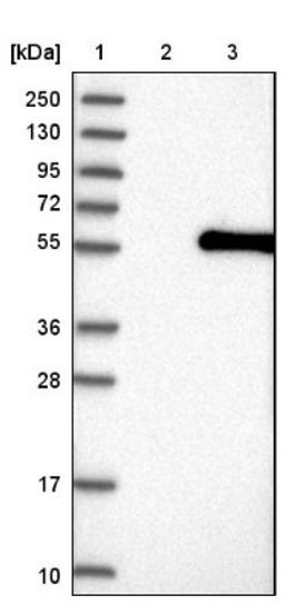 Western Blot: ABHD8 Antibody [NBP1-83728] - Lane 1: Marker [kDa] 250, 130, 95, 72, 55, 36, 28, 17, 10<br/>Lane 2: Negative control (vector only transfected HEK293T lysate)<br/>Lane 3: Over-expression lysate (Co-expressed with a C-terminal myc-DDK tag (~3.1 kDa) in mammalian HEK293T cells, LY411270)