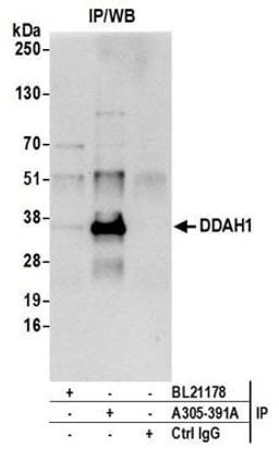 Detection of human DDAH1 by western blot of immunoprecipitates.