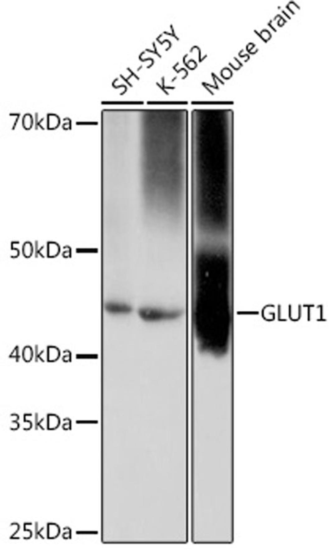 Western blot - GLUT1 pAb (A11727)