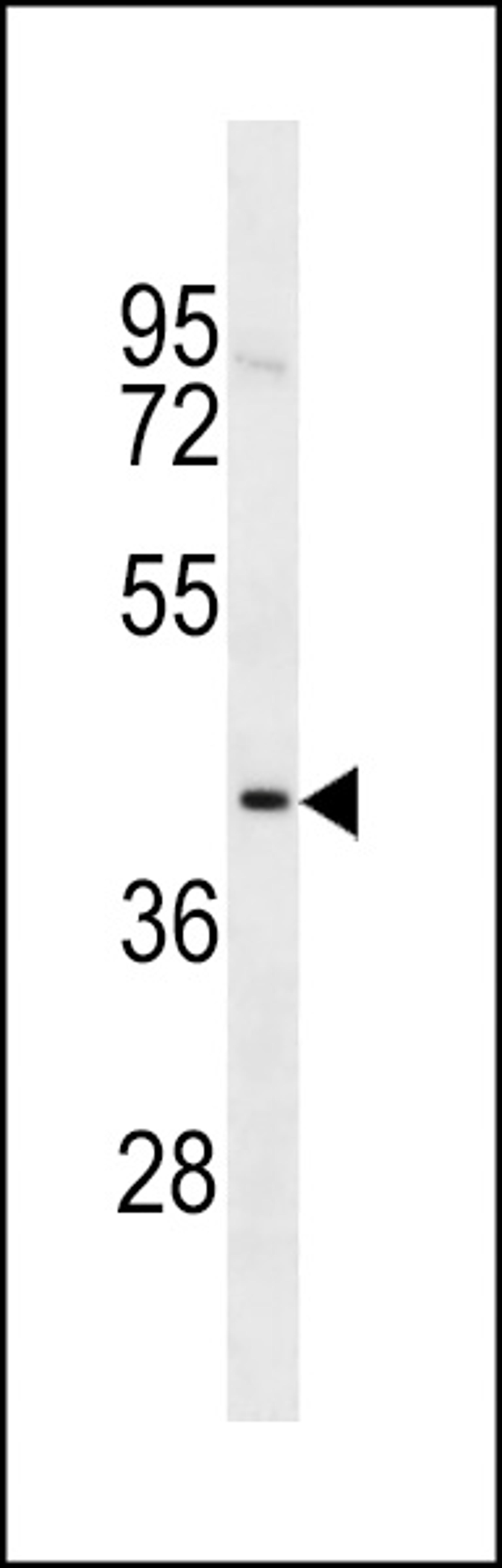 Western blot analysis in MDA-MB231 cell line lysates (35ug/lane).