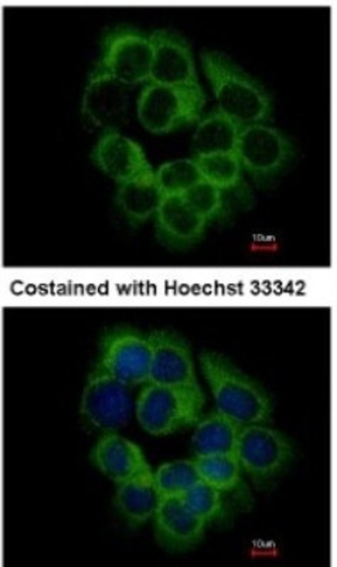 Immunocytochemistry/Immunofluorescence: KIR2DS2 Antibody [NBP2-15005] - Analysis of methanol-fixed A431, using antibody at 1:500 dilution.