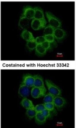 Immunocytochemistry/Immunofluorescence: KIR2DS2 Antibody [NBP2-15005] - Analysis of methanol-fixed A431, using antibody at 1:500 dilution.