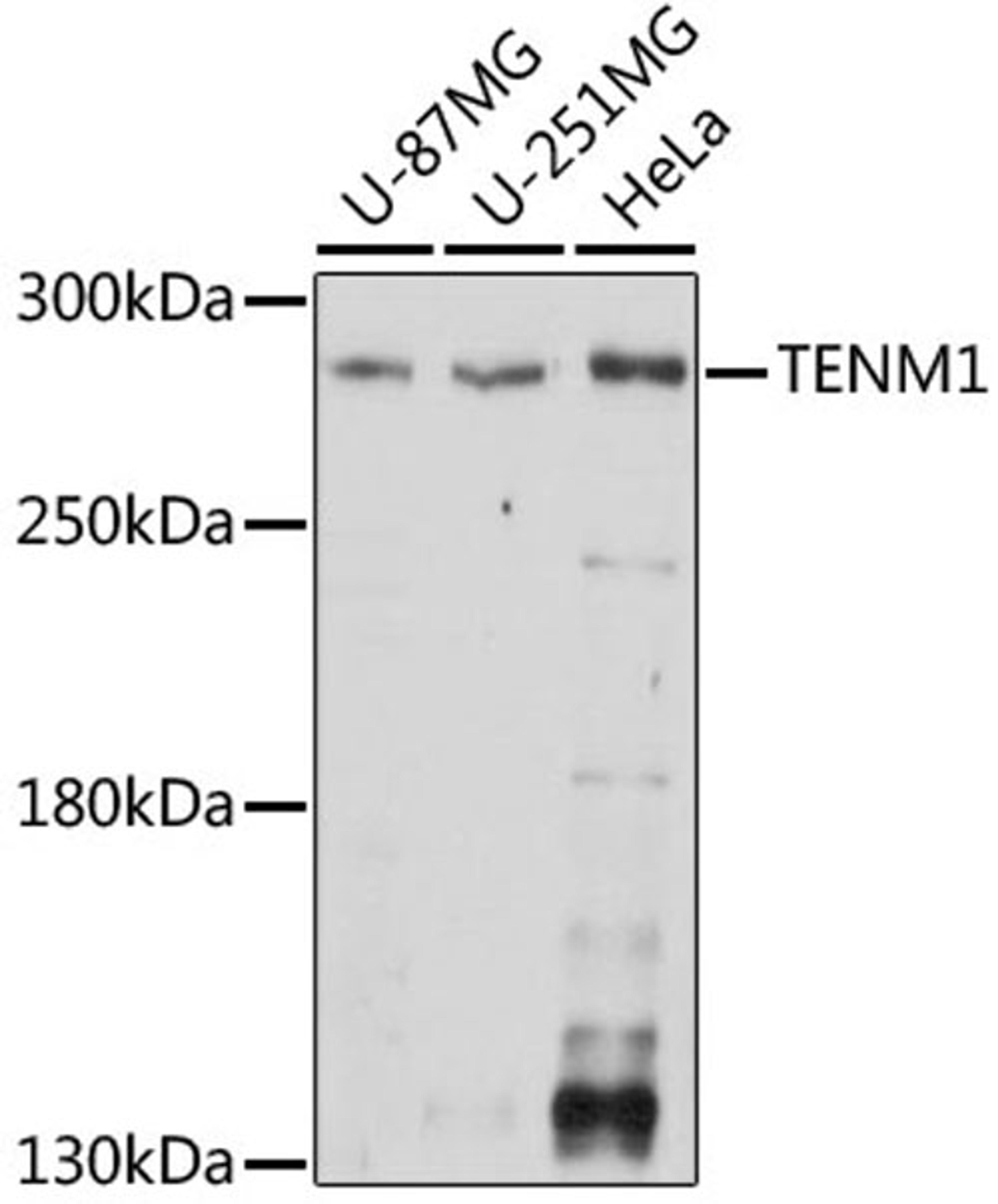 Western blot - TENM1 antibody (A15774)