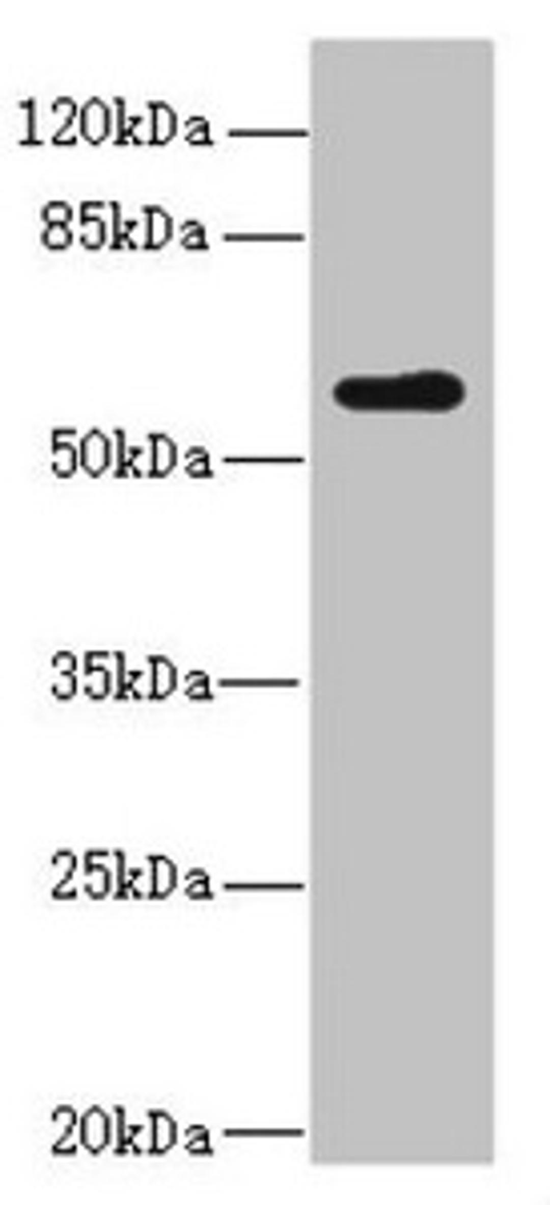 Western blot. All lanes: KPNA5 antibody at 2.04ug/ml + Mouse liver tissue. Secondary. Goat polyclonal to rabbit IgG at 1/10000 dilution. Predicted band size: 60 kDa. Observed band size: 60 kDa.