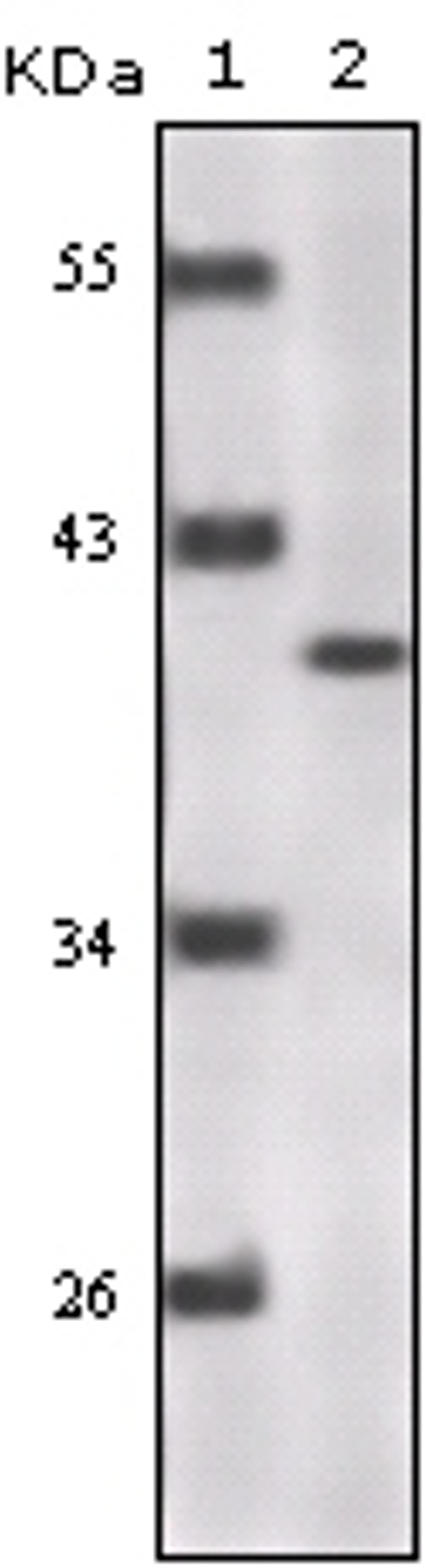 Western blot analysis using P16 monoclonal antibody against truncated P16 recombinant protein.