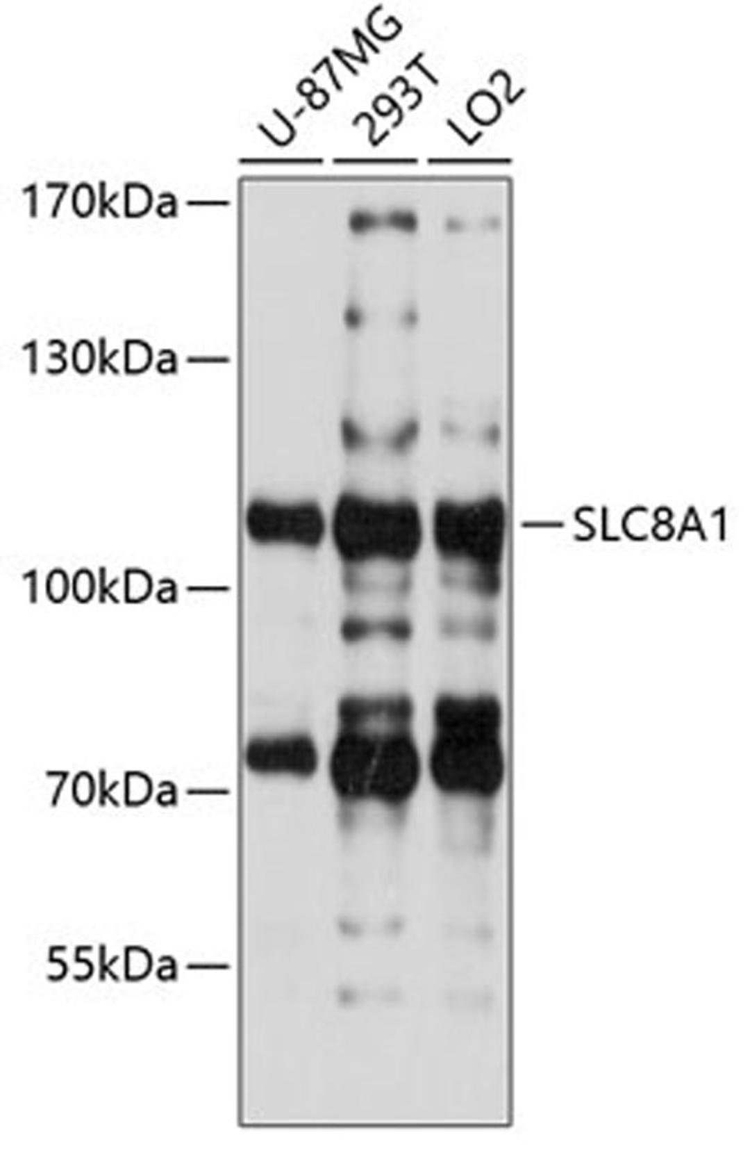 Western blot - SLC8A1 antibody (A5583)