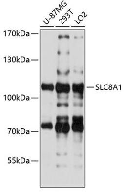 Western blot - SLC8A1 antibody (A5583)