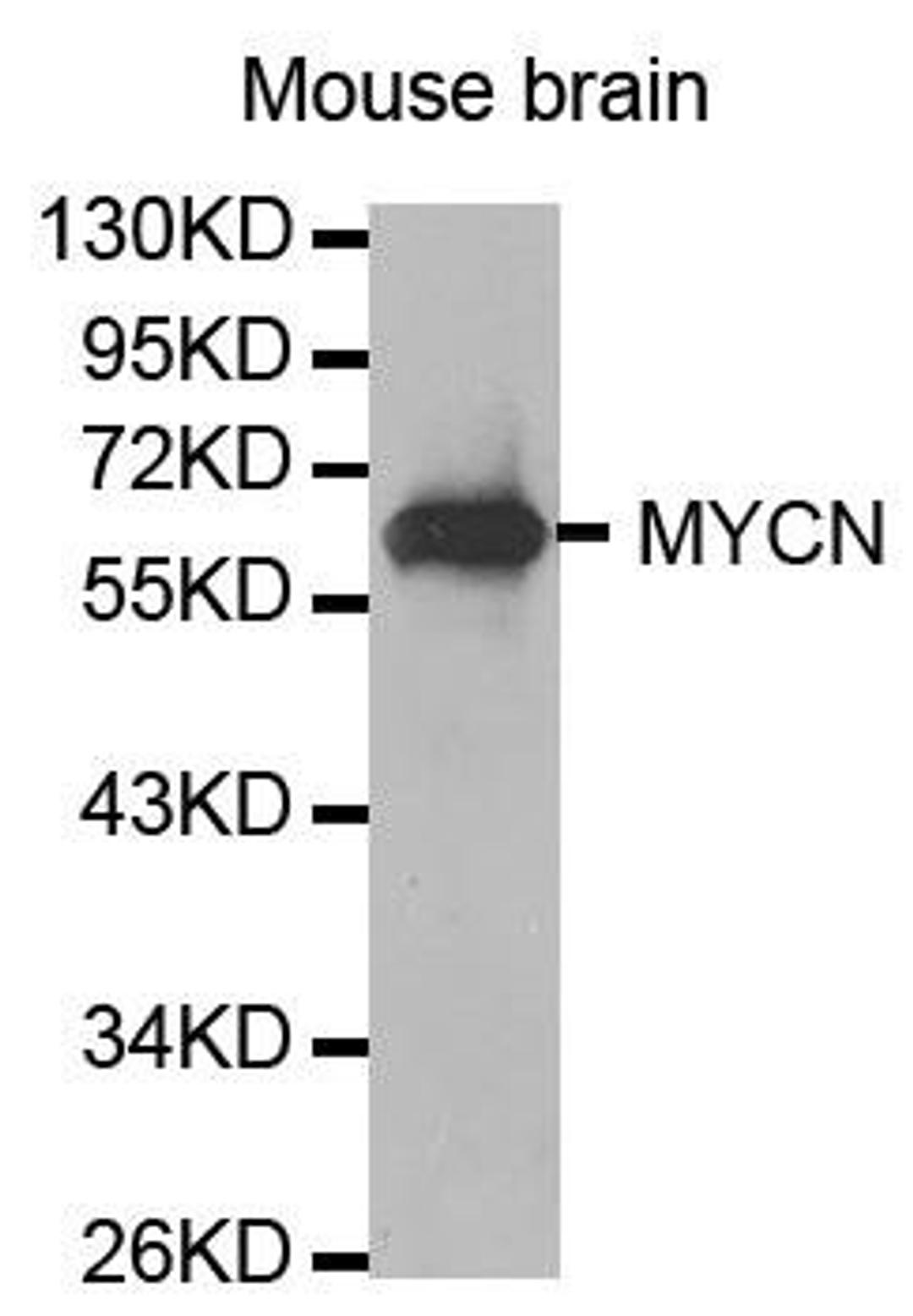 Western blot analysis of extracts of Mouse brain using N-Myc antibody