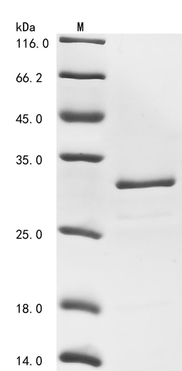 (Tris-Glycine gel) Discontinuous SDS-PAGE (reduced) with 5% enrichment gel and 15% separation gel.