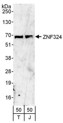 Detection of human ZNF324 by western blot.