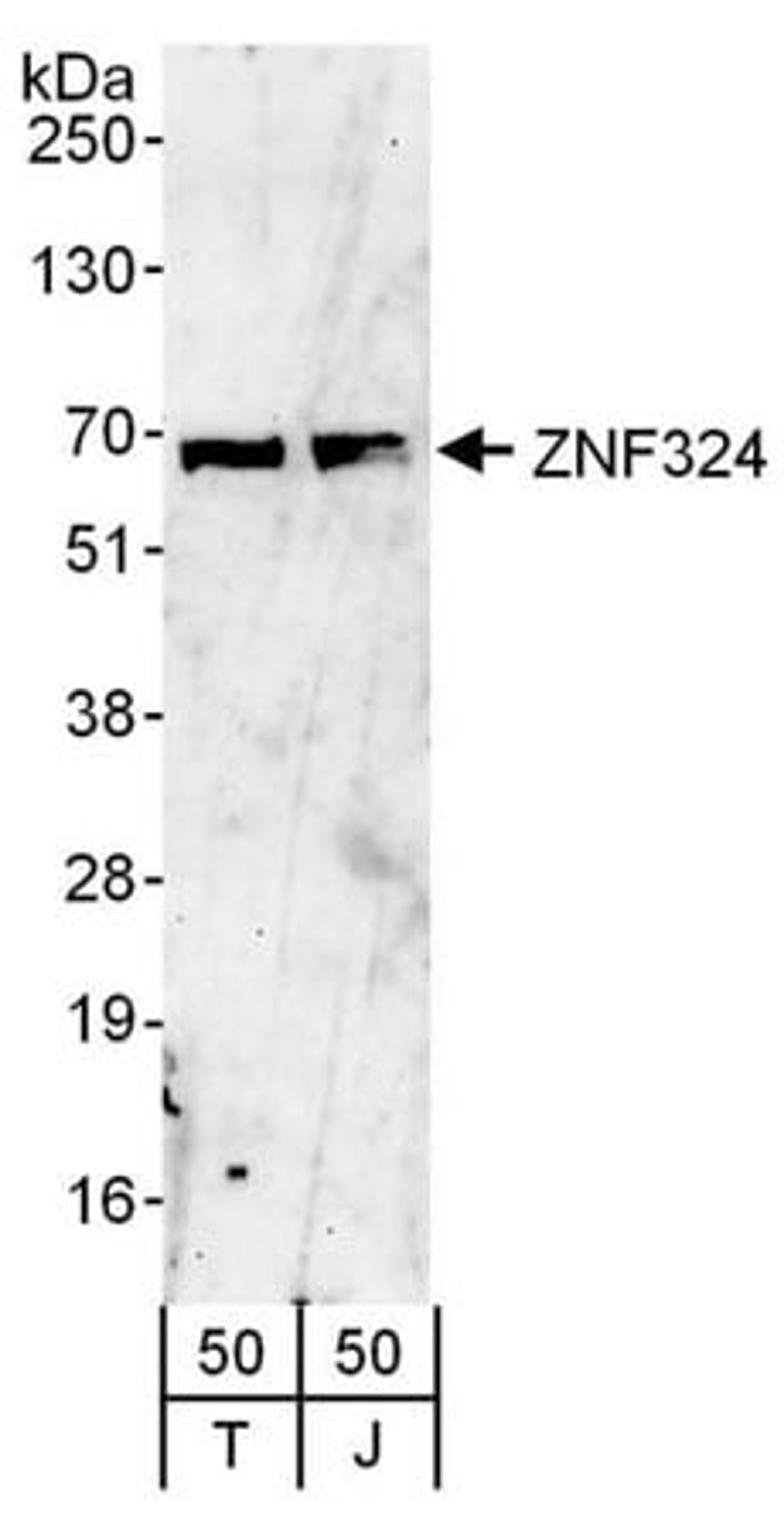 Detection of human ZNF324 by western blot.