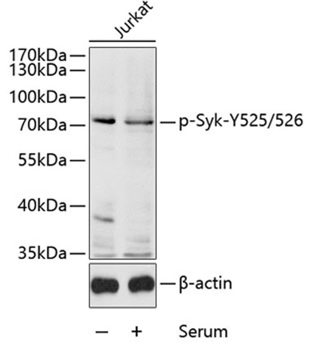 Western blot - Phospho-Syk-Y525/526 antibody (AP0542)