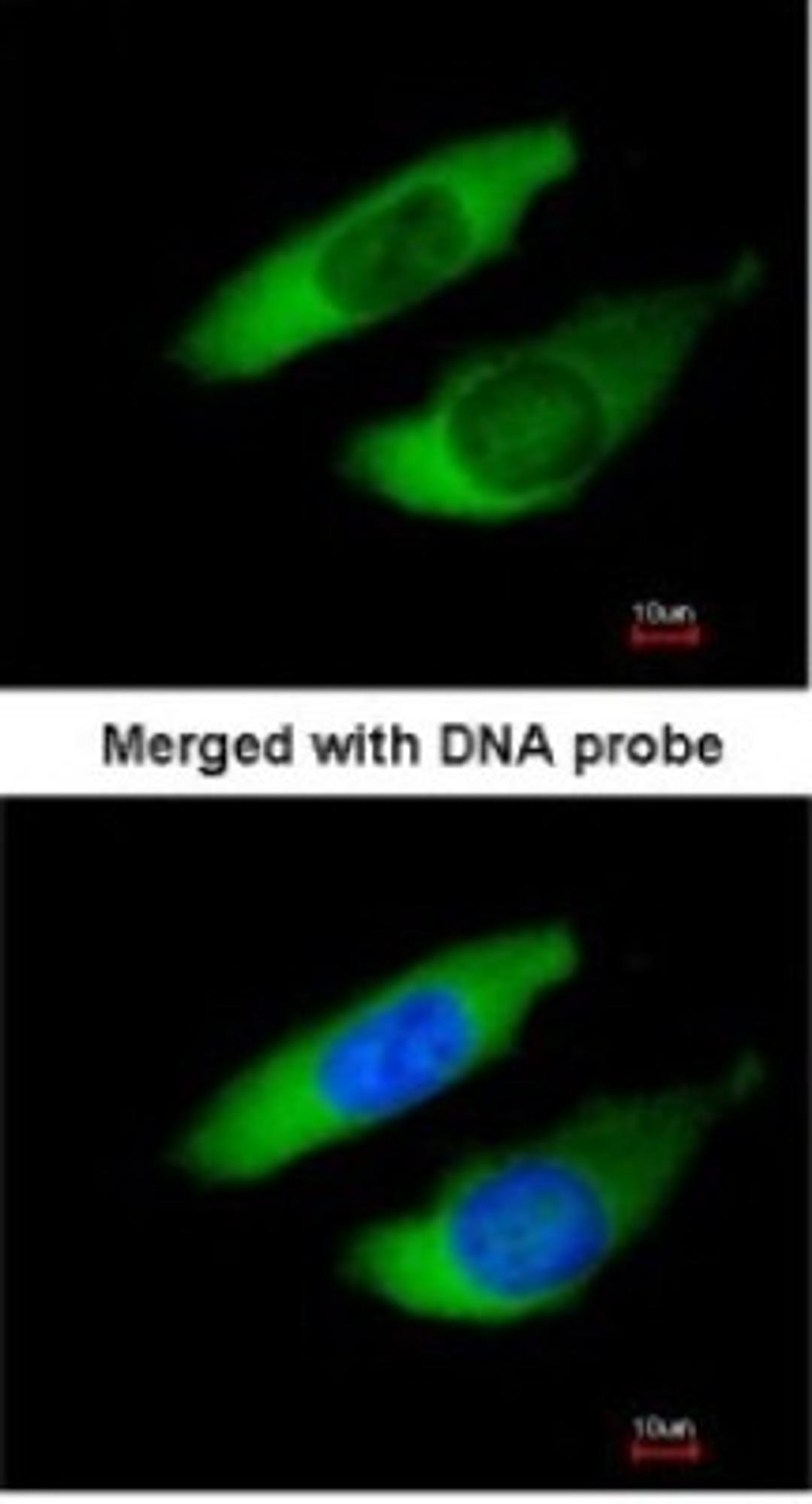 Immunocytochemistry/Immunofluorescence: ARPC2 Antibody [NBP1-32297] - Paraformaldehyde-fixed HeLa, using antibody at 1:200 dilution.