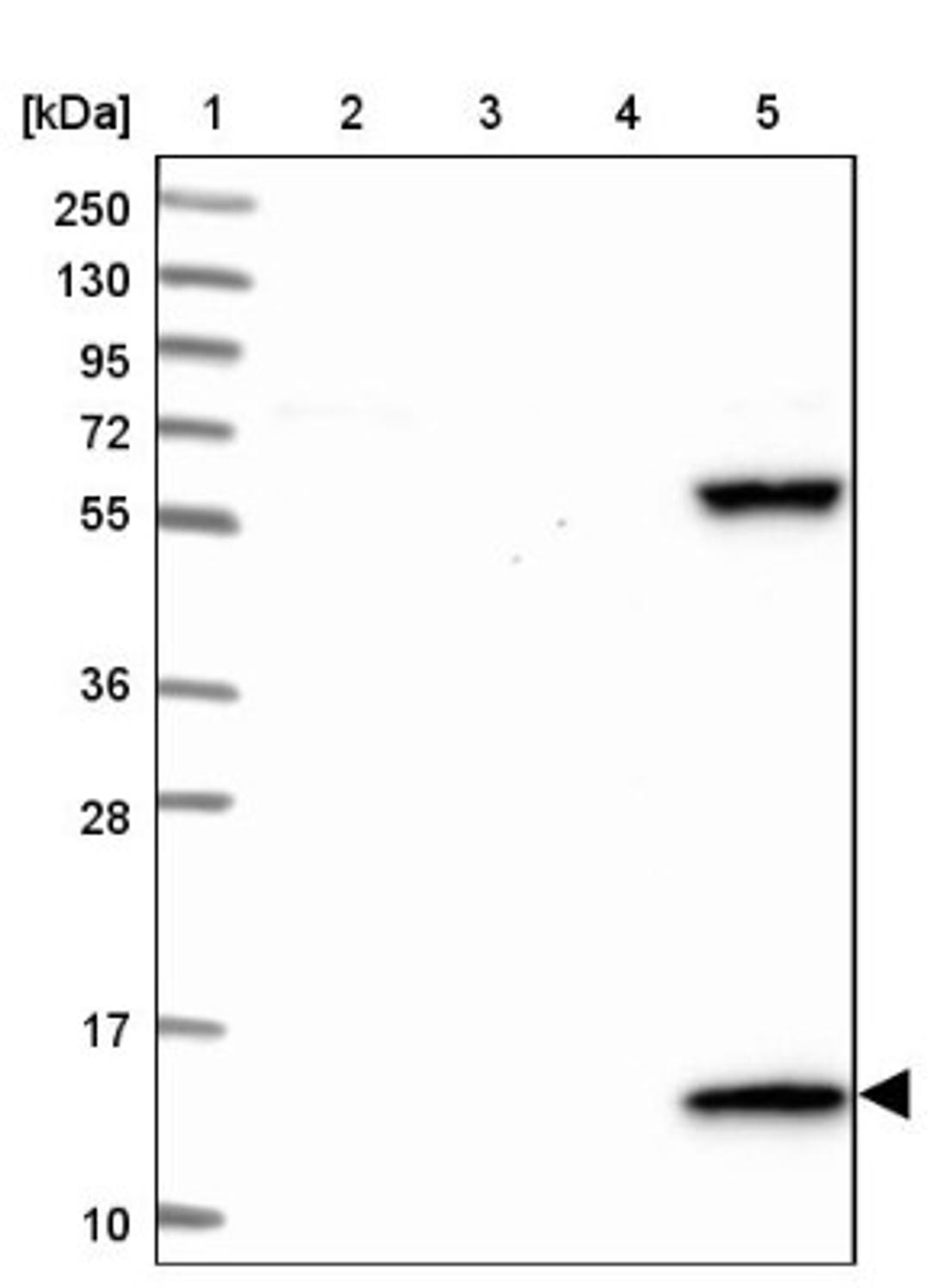 Western Blot: PPP4R4 Antibody [NBP1-81393] - Lane 1: Marker [kDa] 250, 130, 95, 72, 55, 36, 28, 17, 10<br/>Lane 2: Human cell line RT-4<br/>Lane 3: Human cell line U-251MG sp<br/>Lane 4: Human plasma (IgG/HSA depleted)<br/>Lane 5: Human liver tissue