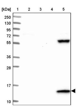 Western Blot: PPP4R4 Antibody [NBP1-81393] - Lane 1: Marker [kDa] 250, 130, 95, 72, 55, 36, 28, 17, 10<br/>Lane 2: Human cell line RT-4<br/>Lane 3: Human cell line U-251MG sp<br/>Lane 4: Human plasma (IgG/HSA depleted)<br/>Lane 5: Human liver tissue