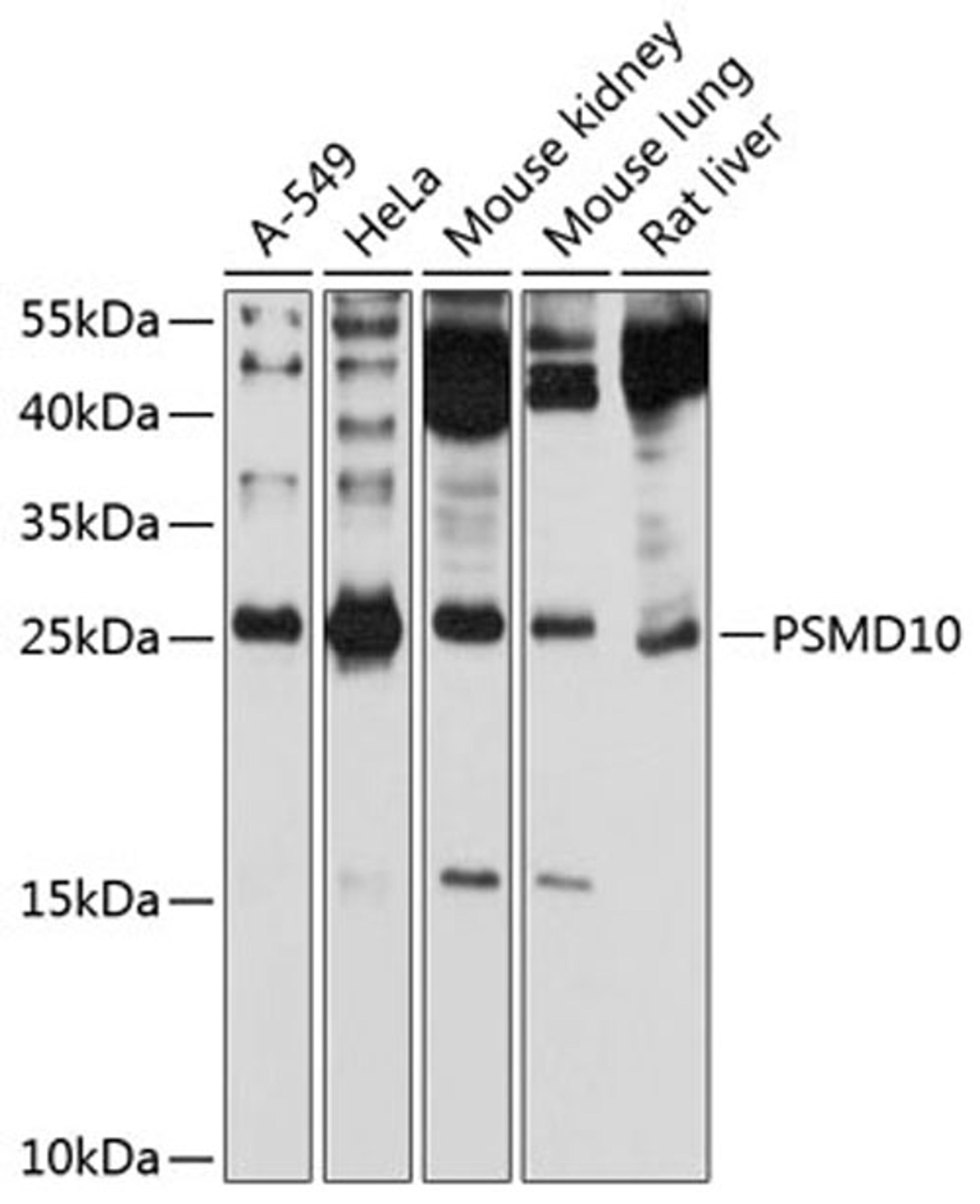 Western blot - PSMD10 antibody (A12469)