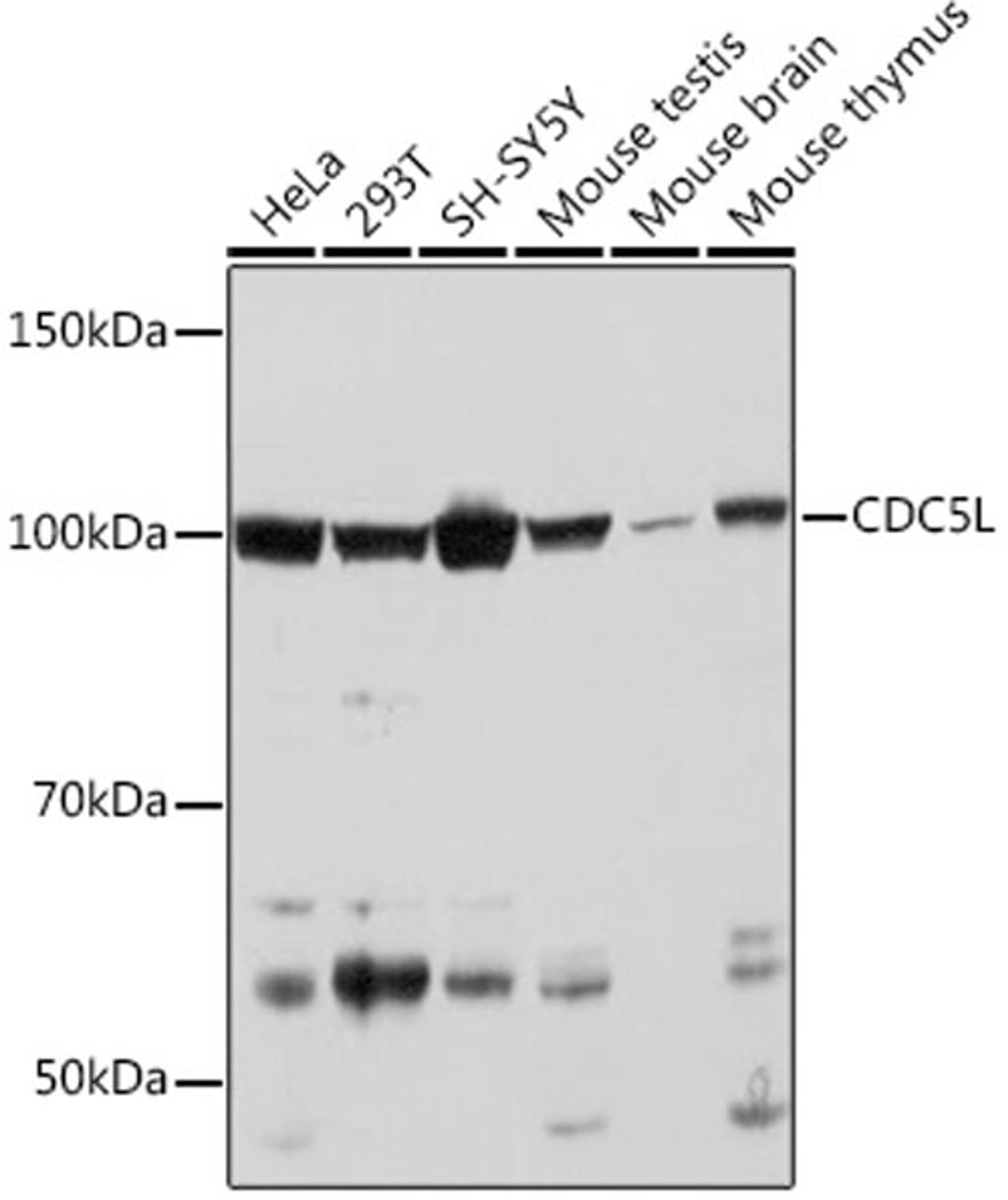 Western blot - CDC5L Rabbit mAb (A9527)