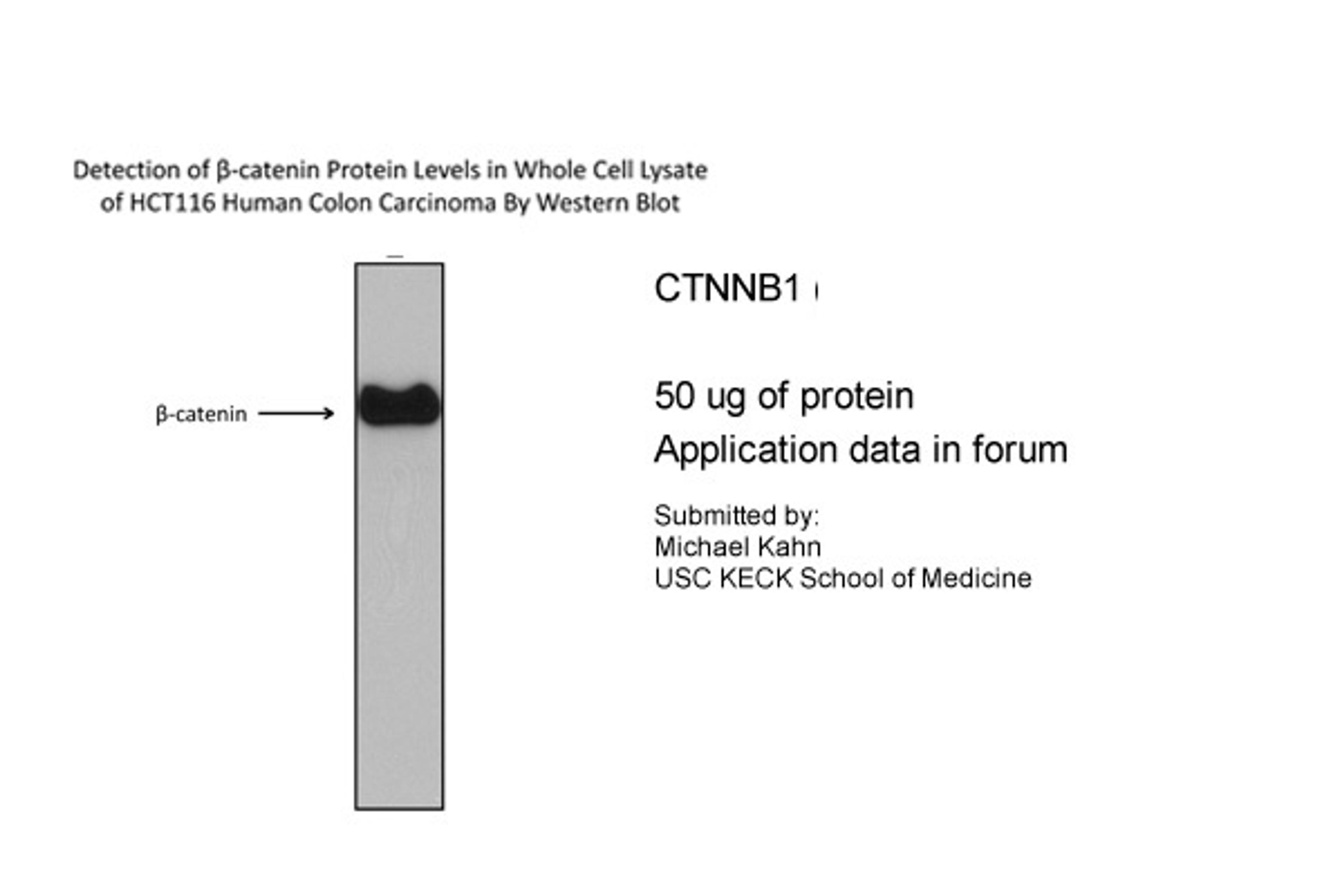 Antibody used in WB on Human HCT116.