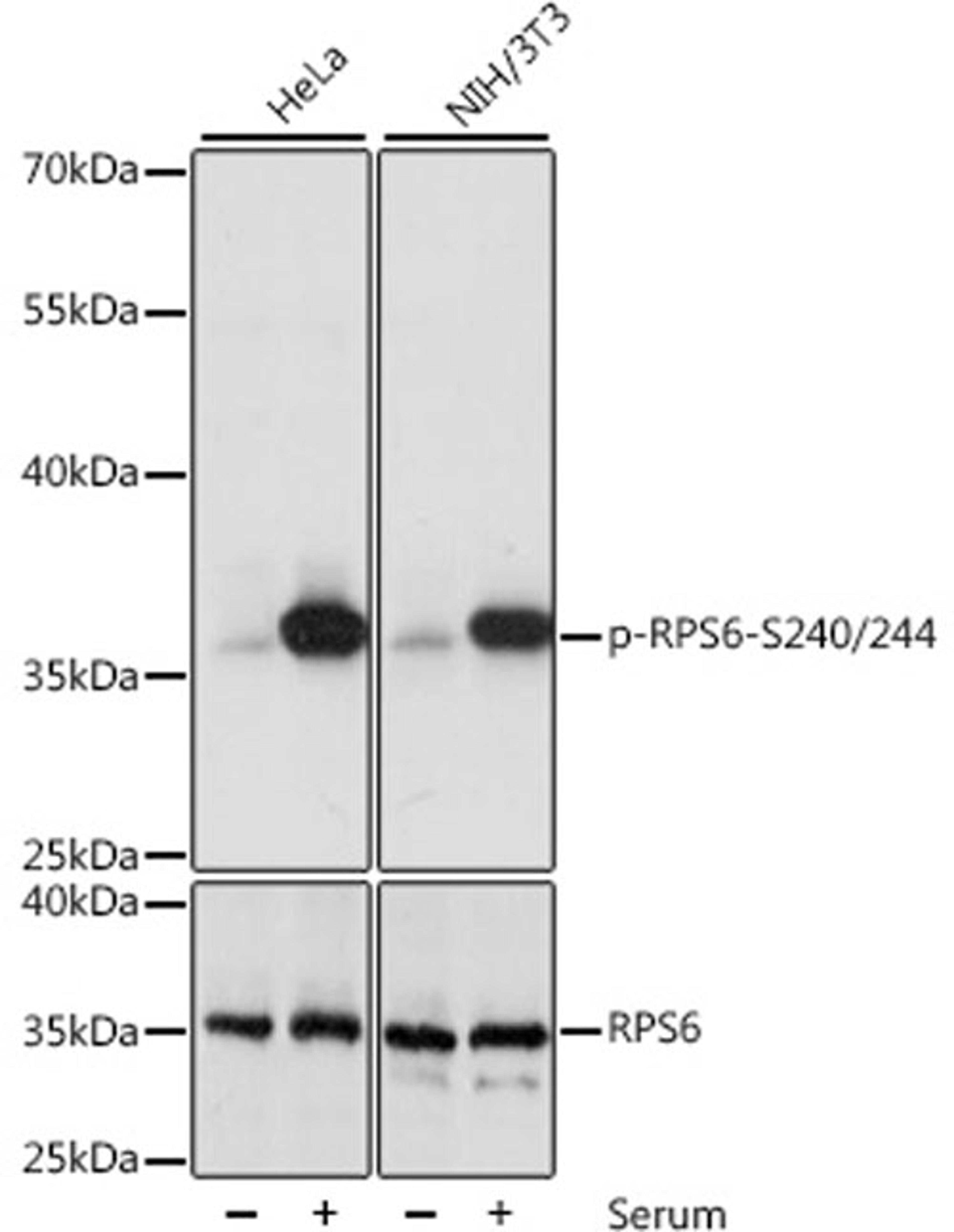 Western blot - Phospho-RPS6KB1-S240/244 antibody (AP0537)