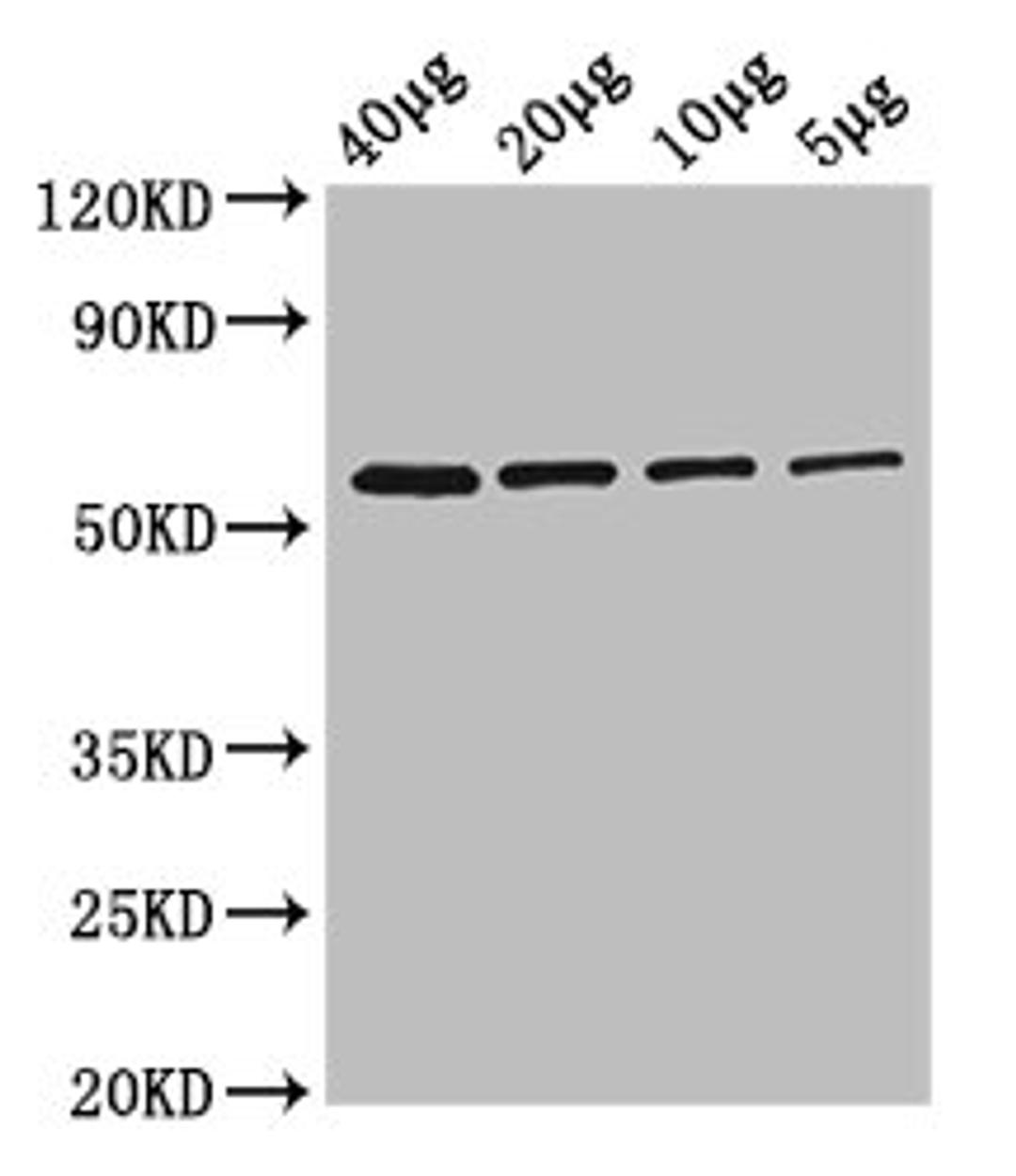 Western Blot. Positive WB detected in: Rosseta bacteria lysate at 40µg, 20µg, 10µg, 5µg. All lanes: glpK antibody at 2.5µg/ml. Secondary. Goat polyclonal to rabbit IgG at 1/50000 dilution. Predicted band size: 57 kDa. Observed band size: 57 kDa
