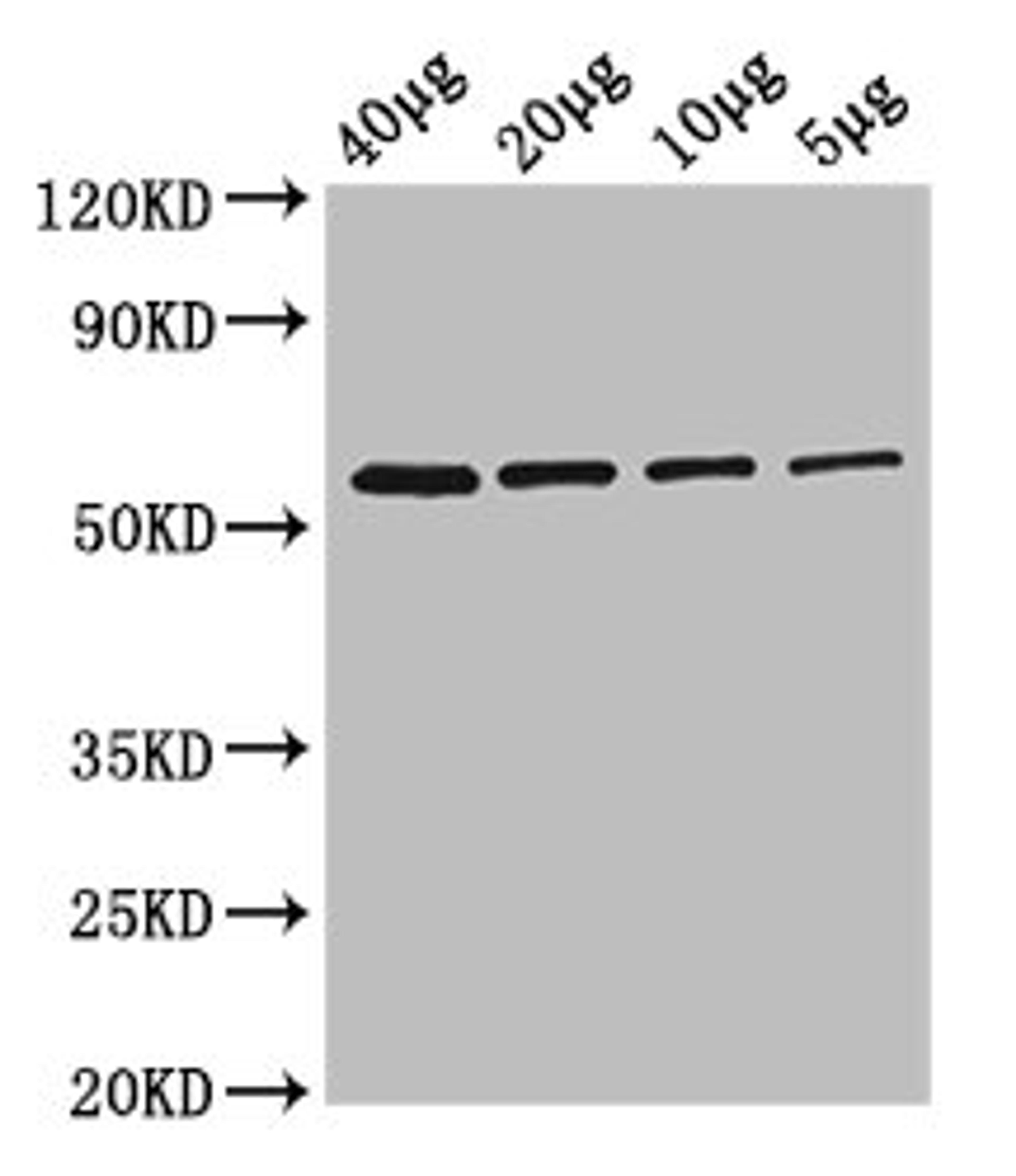 Western Blot. Positive WB detected in: Rosseta bacteria lysate at 40µg, 20µg, 10µg, 5µg. All lanes: glpK antibody at 2.5µg/ml. Secondary. Goat polyclonal to rabbit IgG at 1/50000 dilution. Predicted band size: 57 kDa. Observed band size: 57 kDa