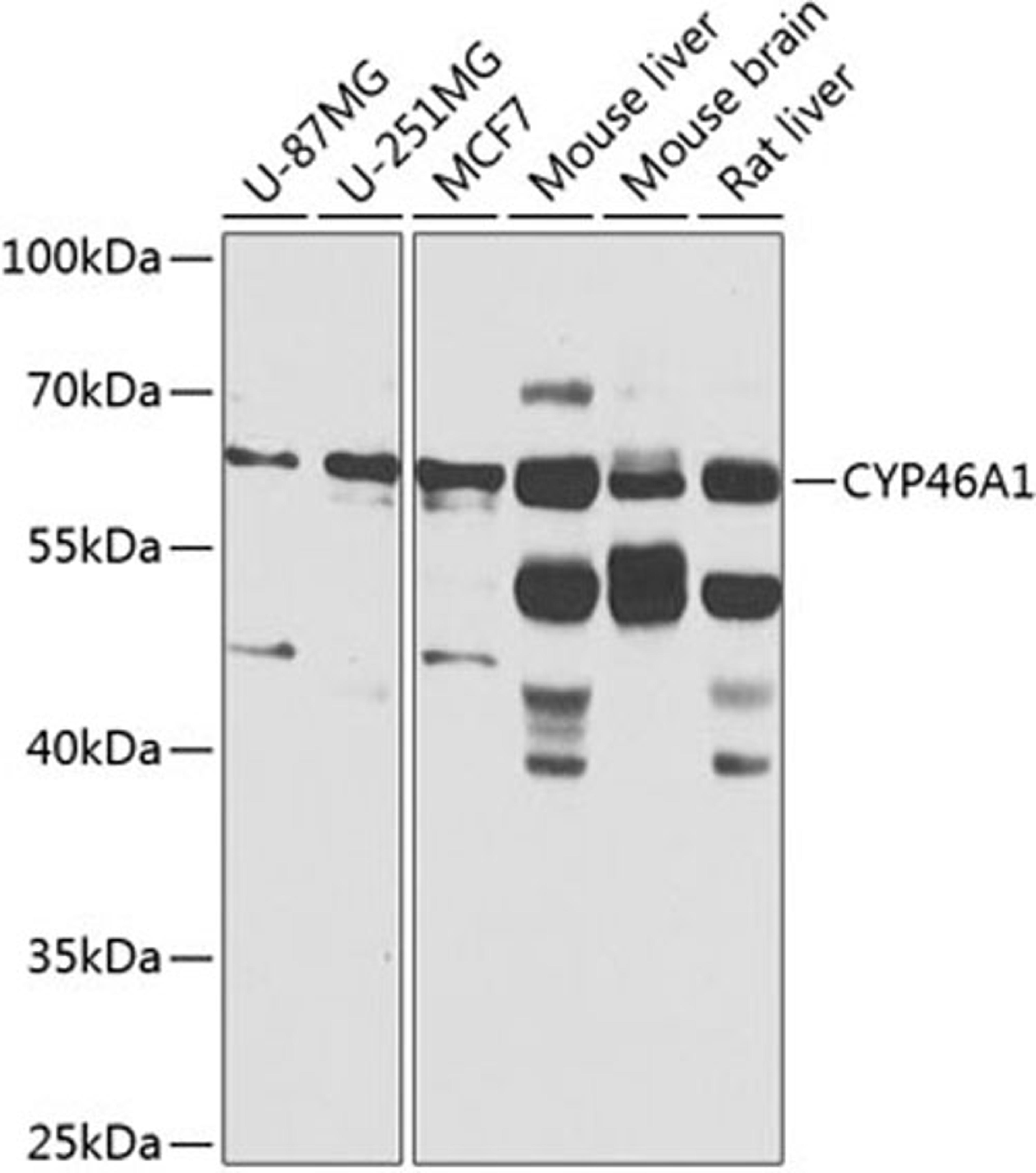 Western blot - CYP46A1 antibody (A8573)