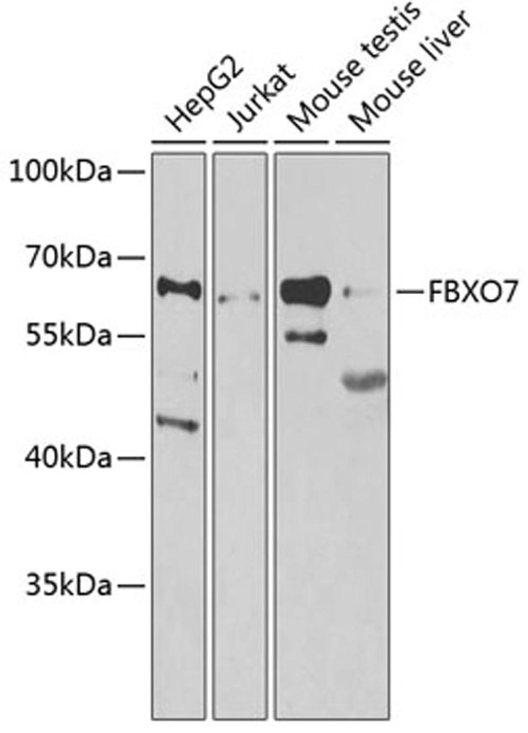 Western blot - FBXO7 antibody (A7464)