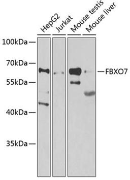 Western blot - FBXO7 antibody (A7464)