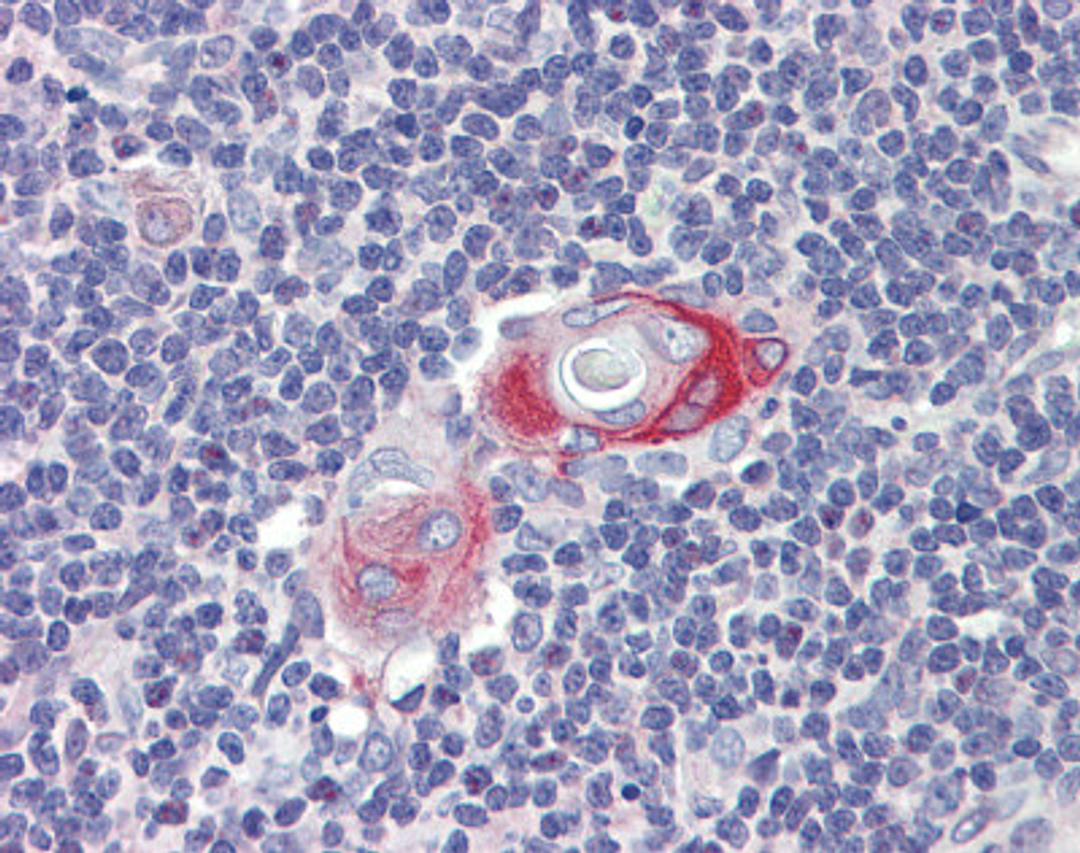 Antibody used in IHC on Human thymus at 10 ug/ml.