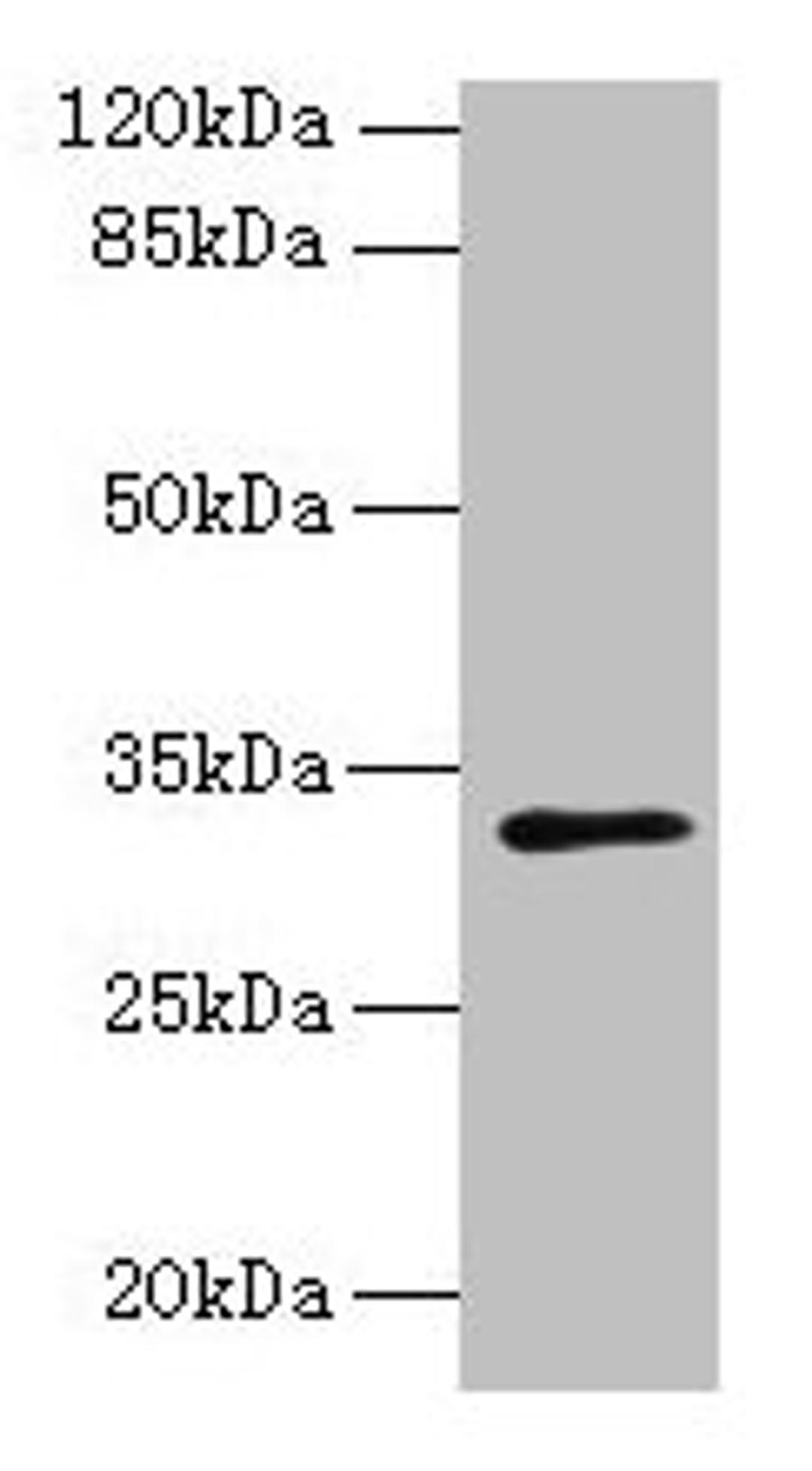 Western blot. All lanes: PLPP2 antibody at 8µg/ml + MCF-7 whole cell lysate. Secondary. Goat polyclonal to rabbit IgG at 1/10000 dilution. Predicted band size: 33, 35, 27 kDa. Observed band size: 33 kDa